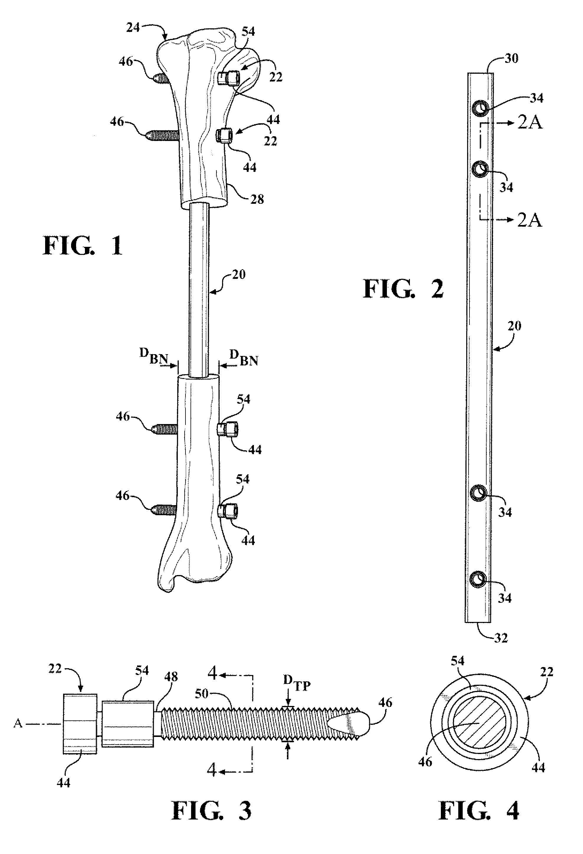 Easily implantable and stable nail-fastener for skeletal fixation and method