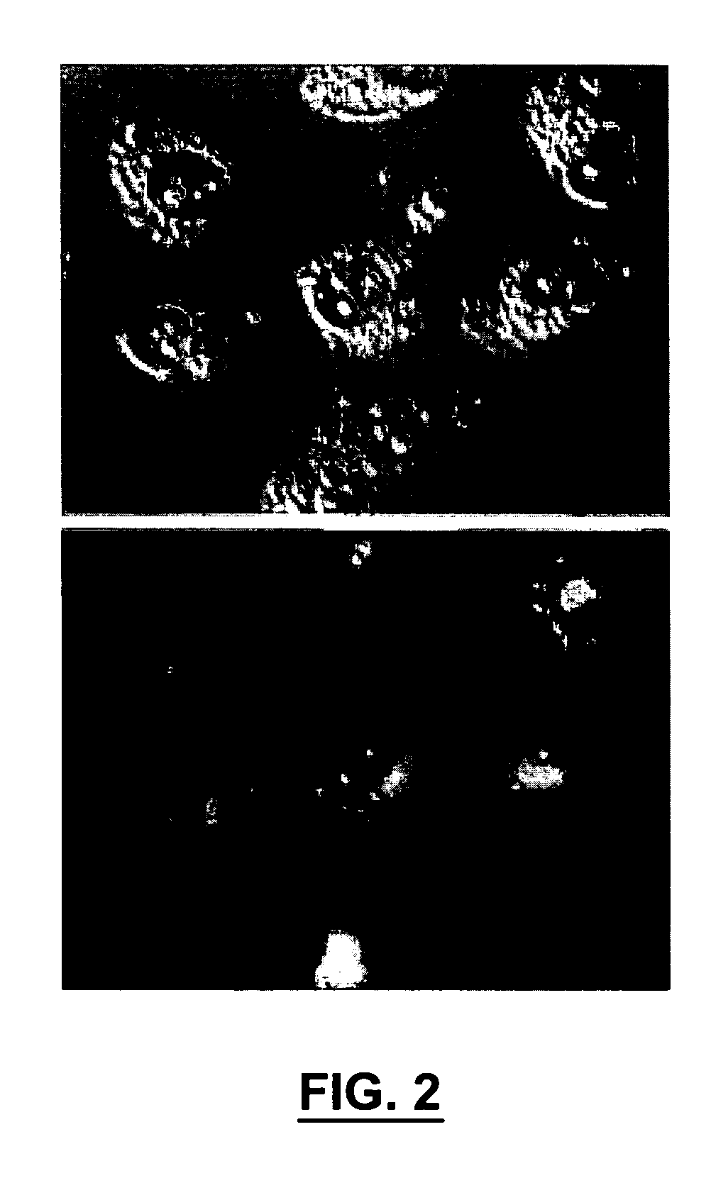 Bone treatment instrument and method