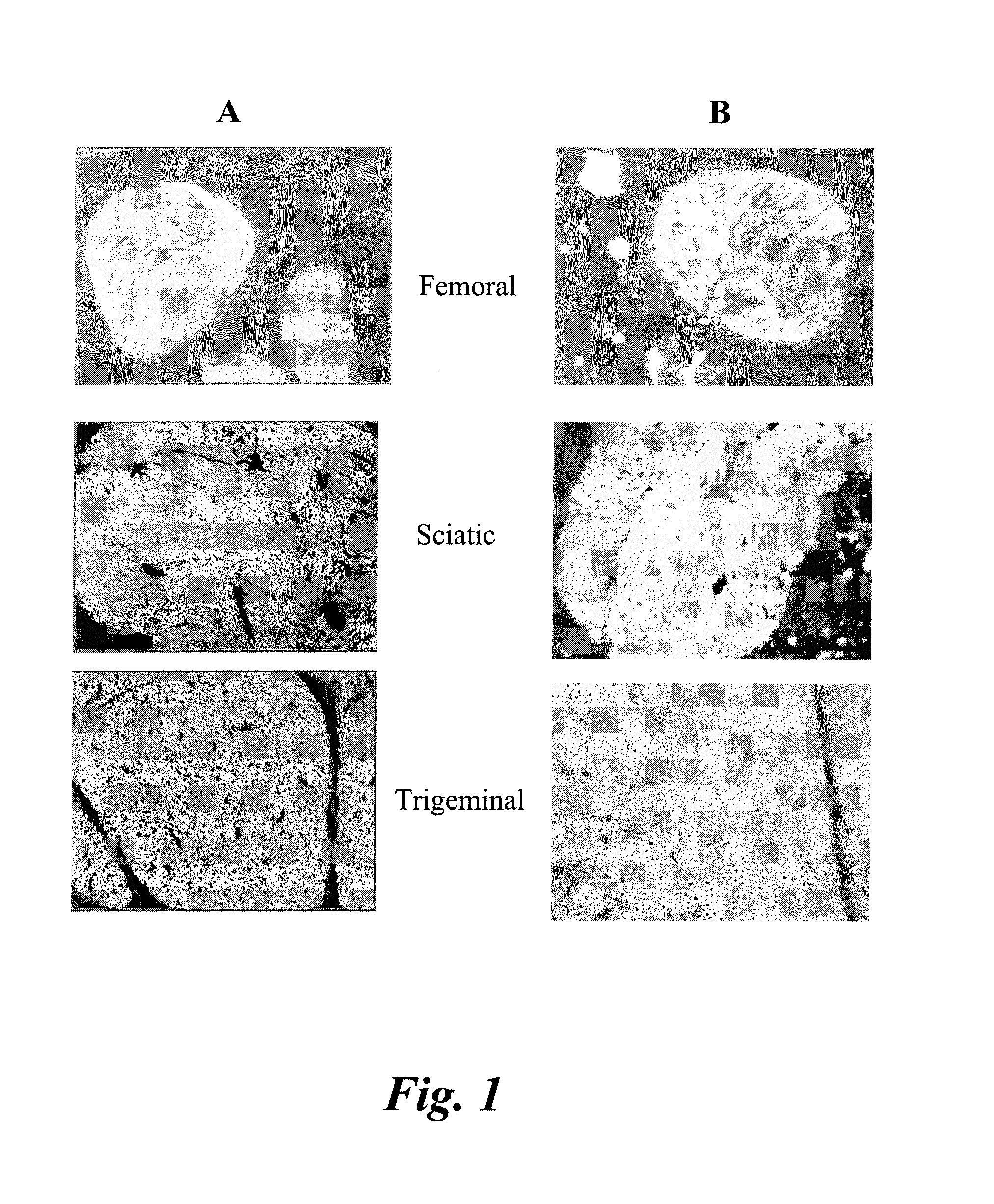 Imaging of myelin basic protein