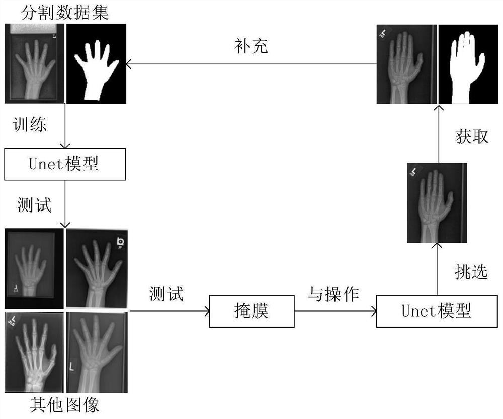 Weighted bone age evaluation method and system based on deep learning