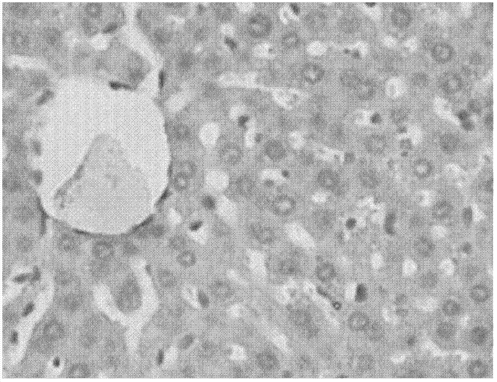 Application of medicine composition in preparation of medicines for preventing or treating fatty liver