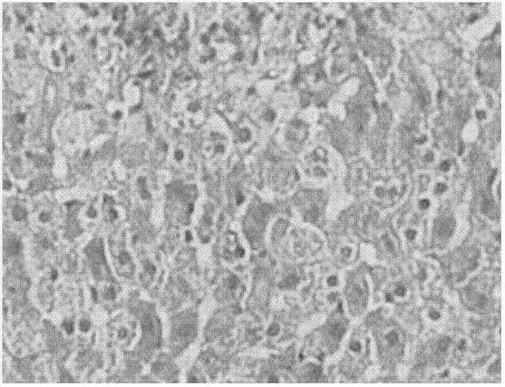 Application of medicine composition in preparation of medicines for preventing or treating fatty liver