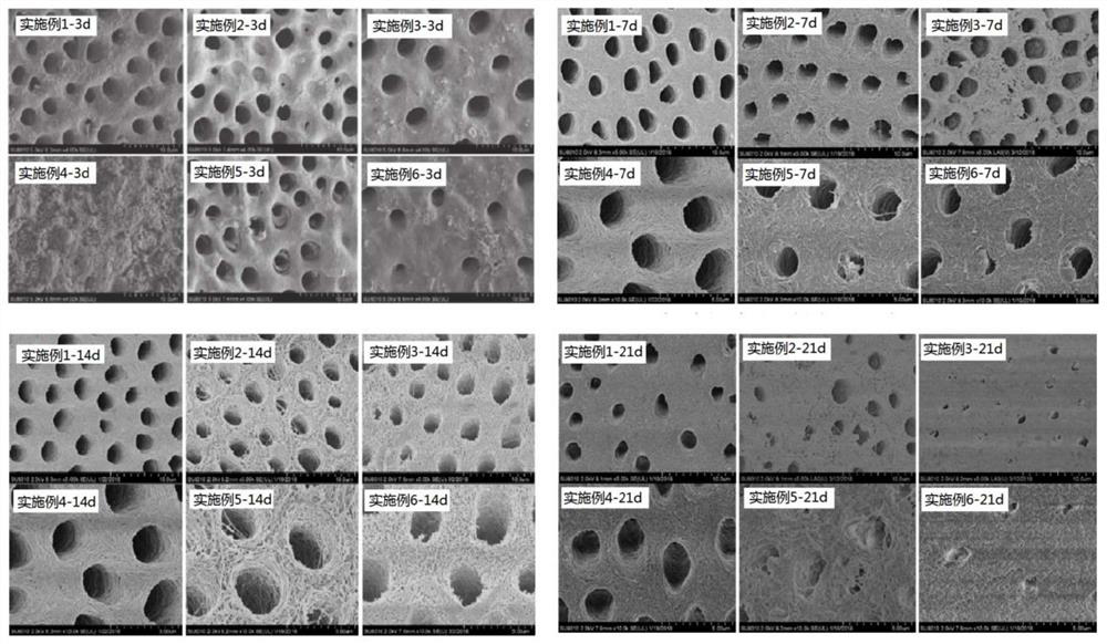 Dental self-acid-etching adhesive with remineralization effect, and preparation method thereof