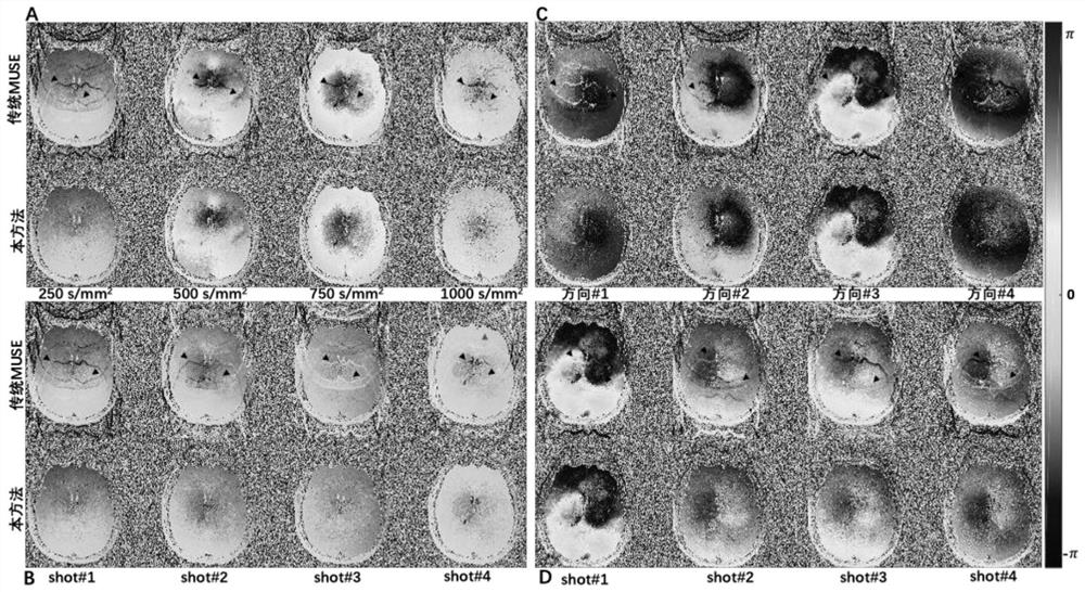 Multiple-shot planar echo magnetic resonance imaging method based on neural network