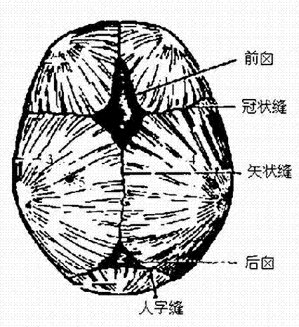 A non-contact magnetic induction cerebral hemorrhage detection system