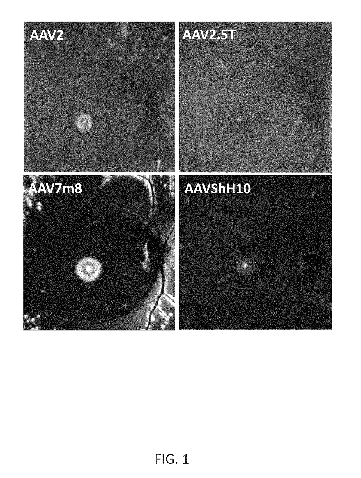 Compositions and methods for intravitreal delivery of polynucleotides to retinal cones