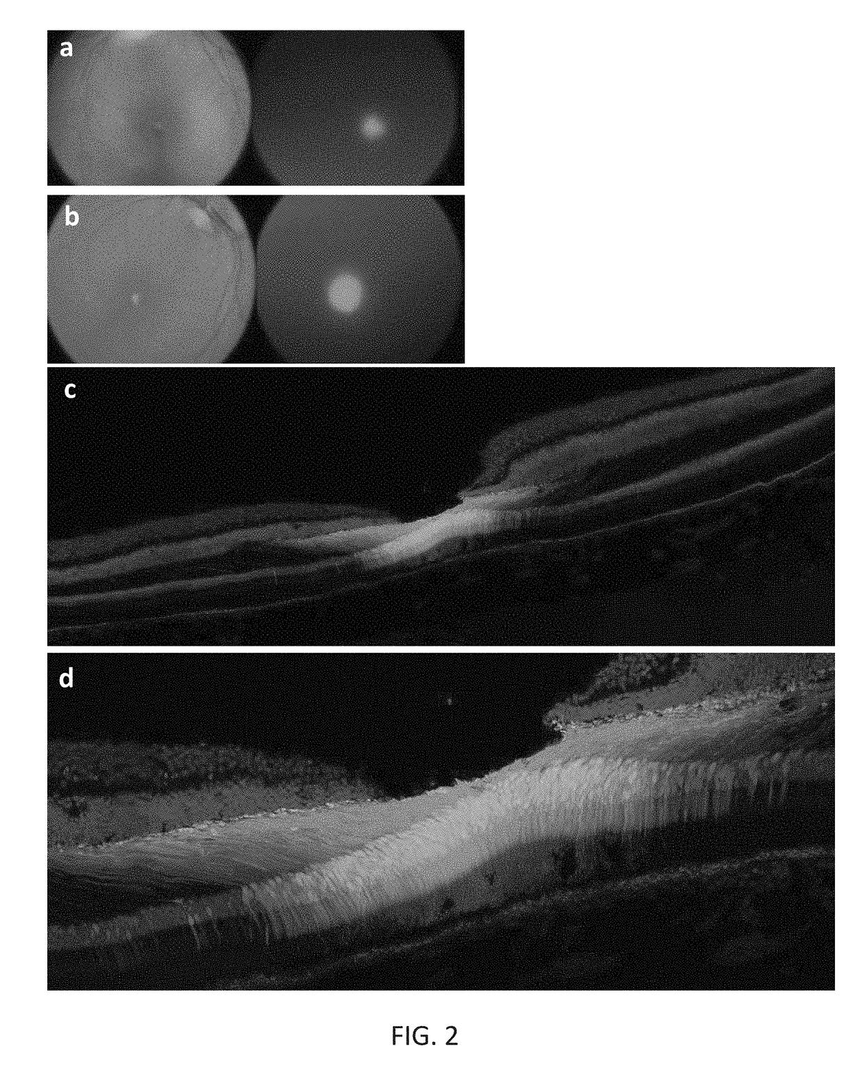 Compositions and methods for intravitreal delivery of polynucleotides to retinal cones