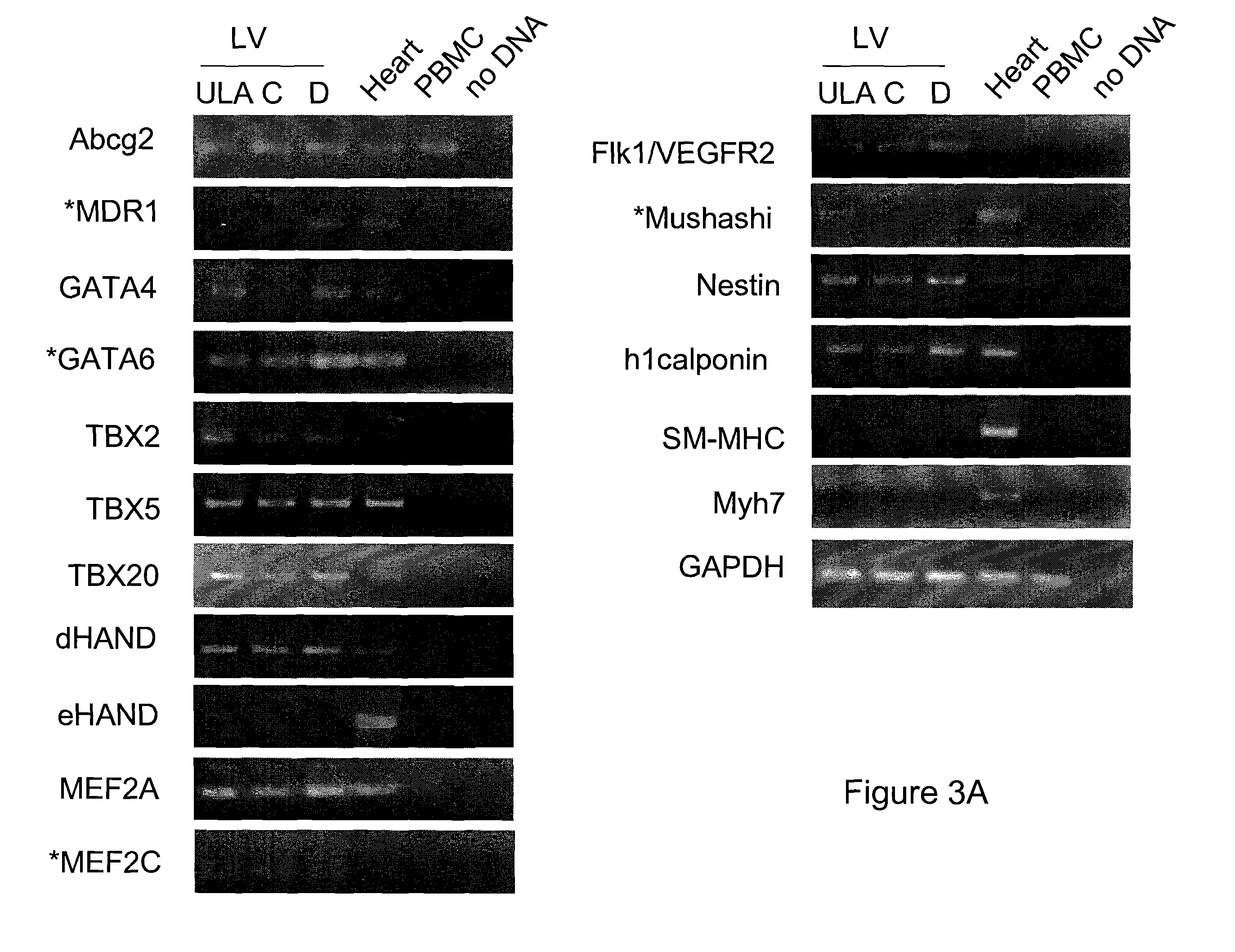 Adult Human Cardiac-Derived Progenitor Cells