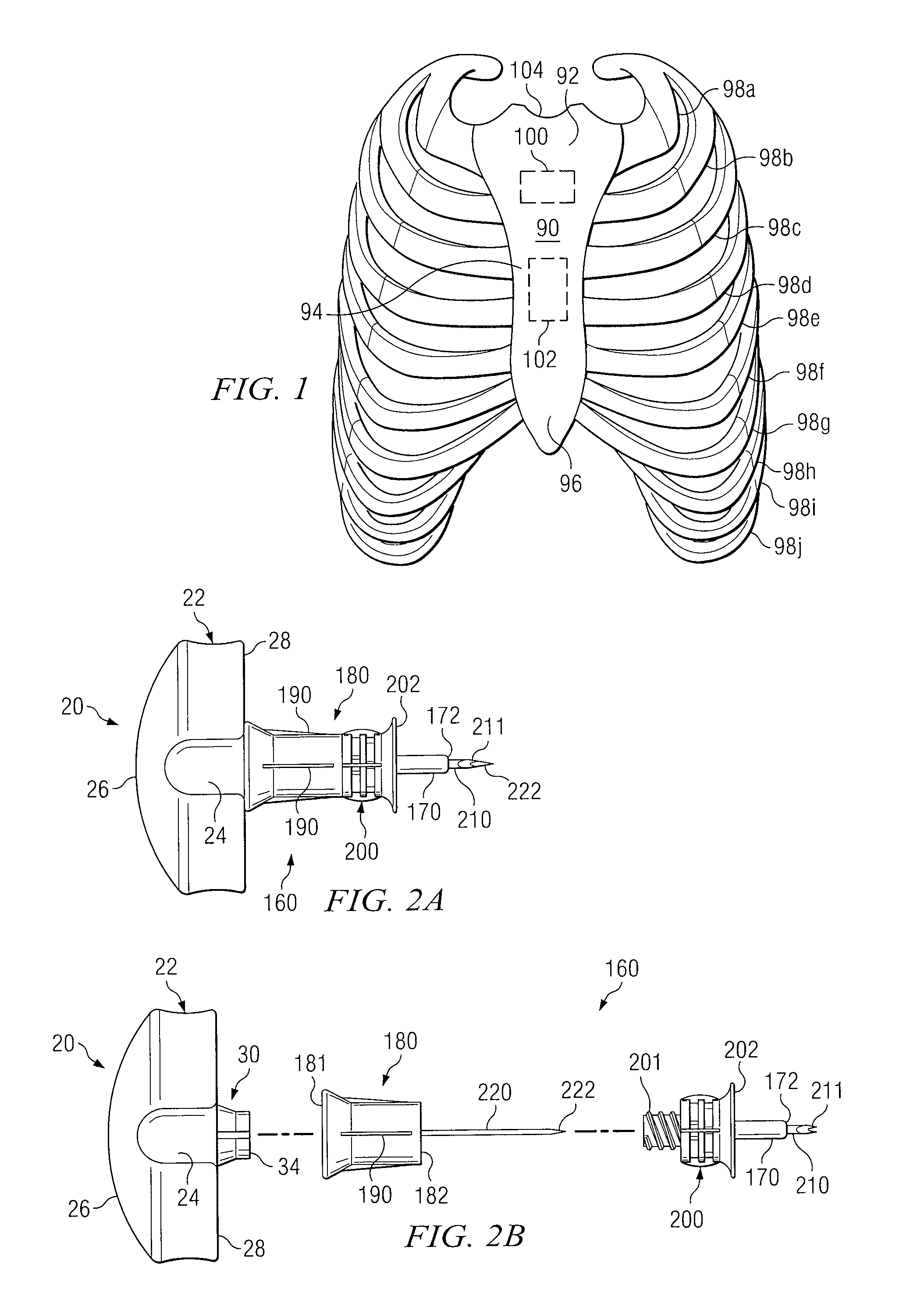 Intraosseous device and methods for accessing bone marrow in the sternum and other target areas