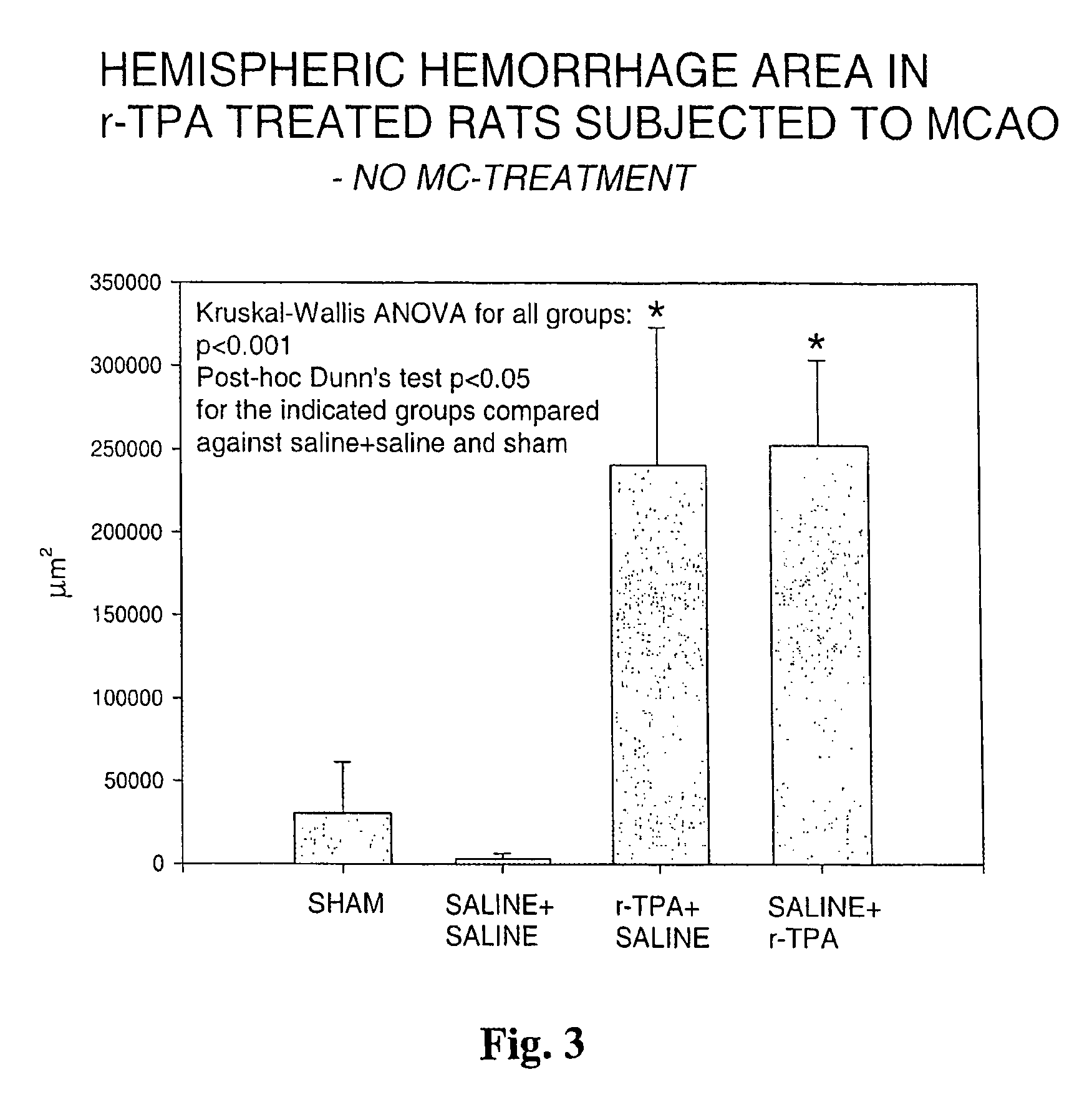 Use of a mast cell activation or degranulation blocking agent in the manufacture of a medicament for the treatment of a patient subjected to thrombolyses