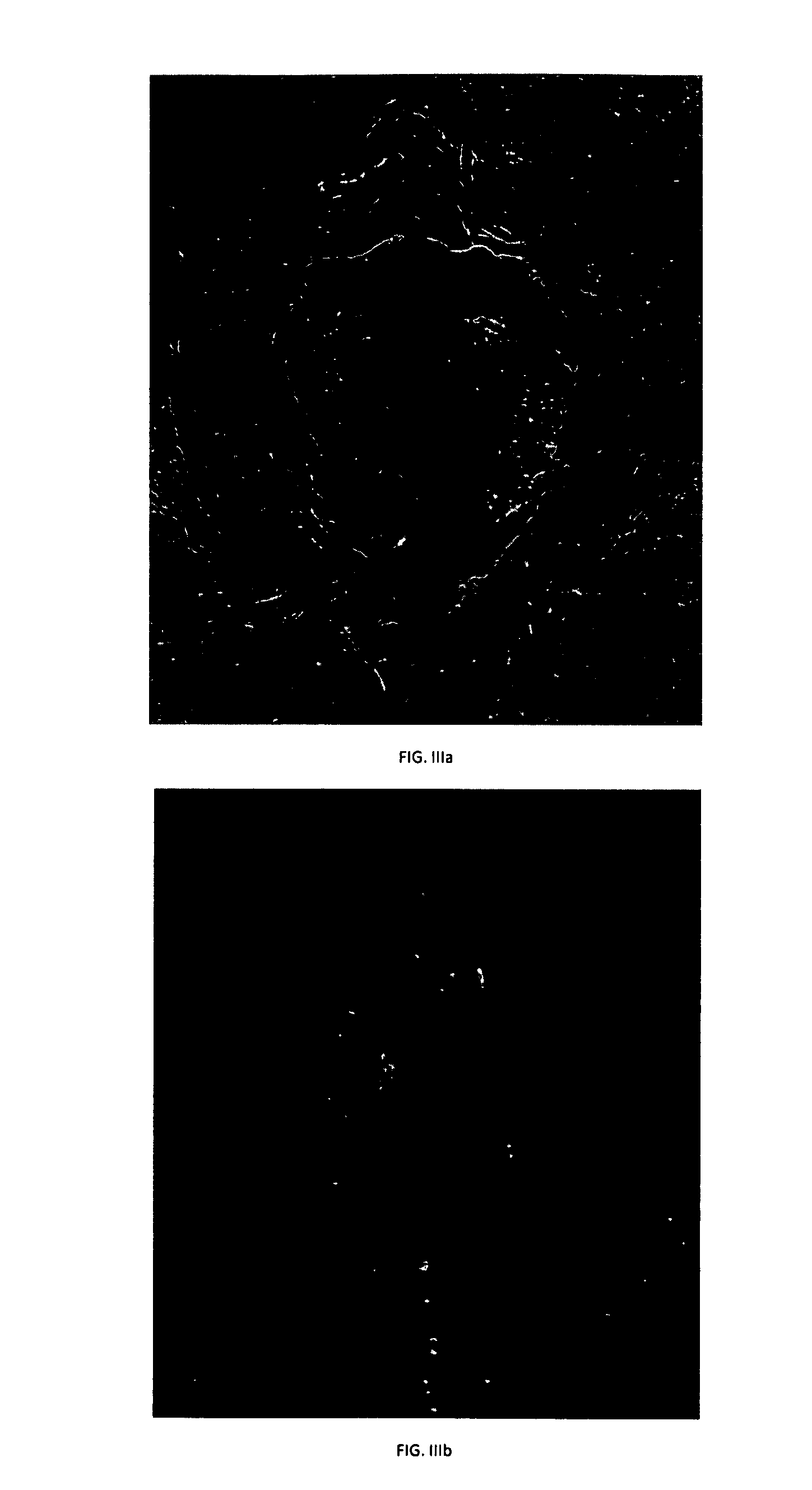 Method for correction of female urinary incontinence and skin reduction