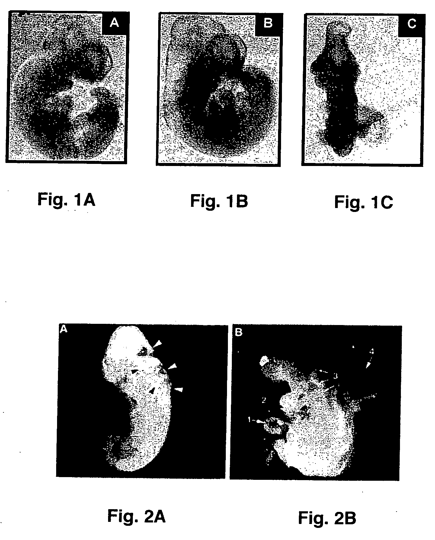 Maternal multi-nutrient against diabetes-related birth defects