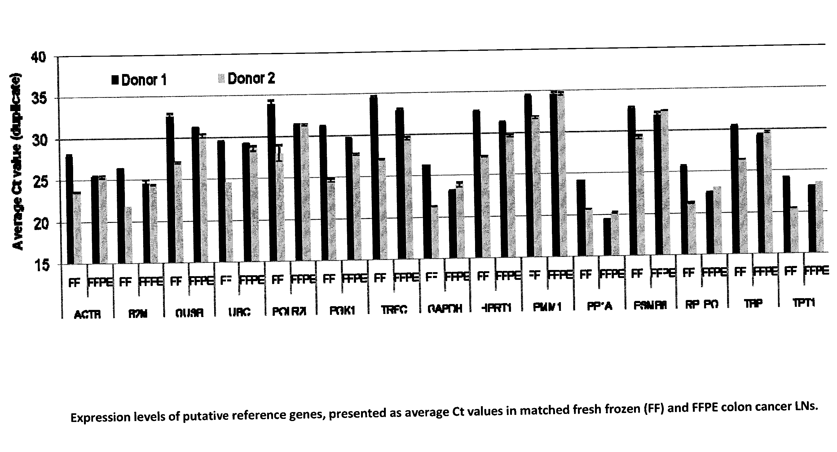 Method for Detecting Metastasis of GI Cancer