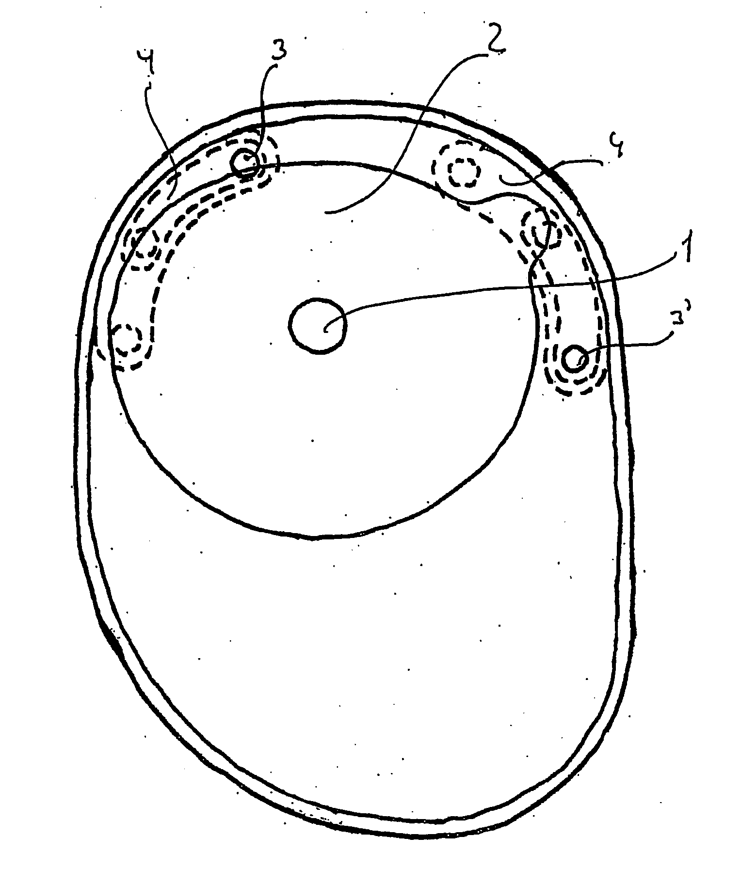 Ostomy appliance