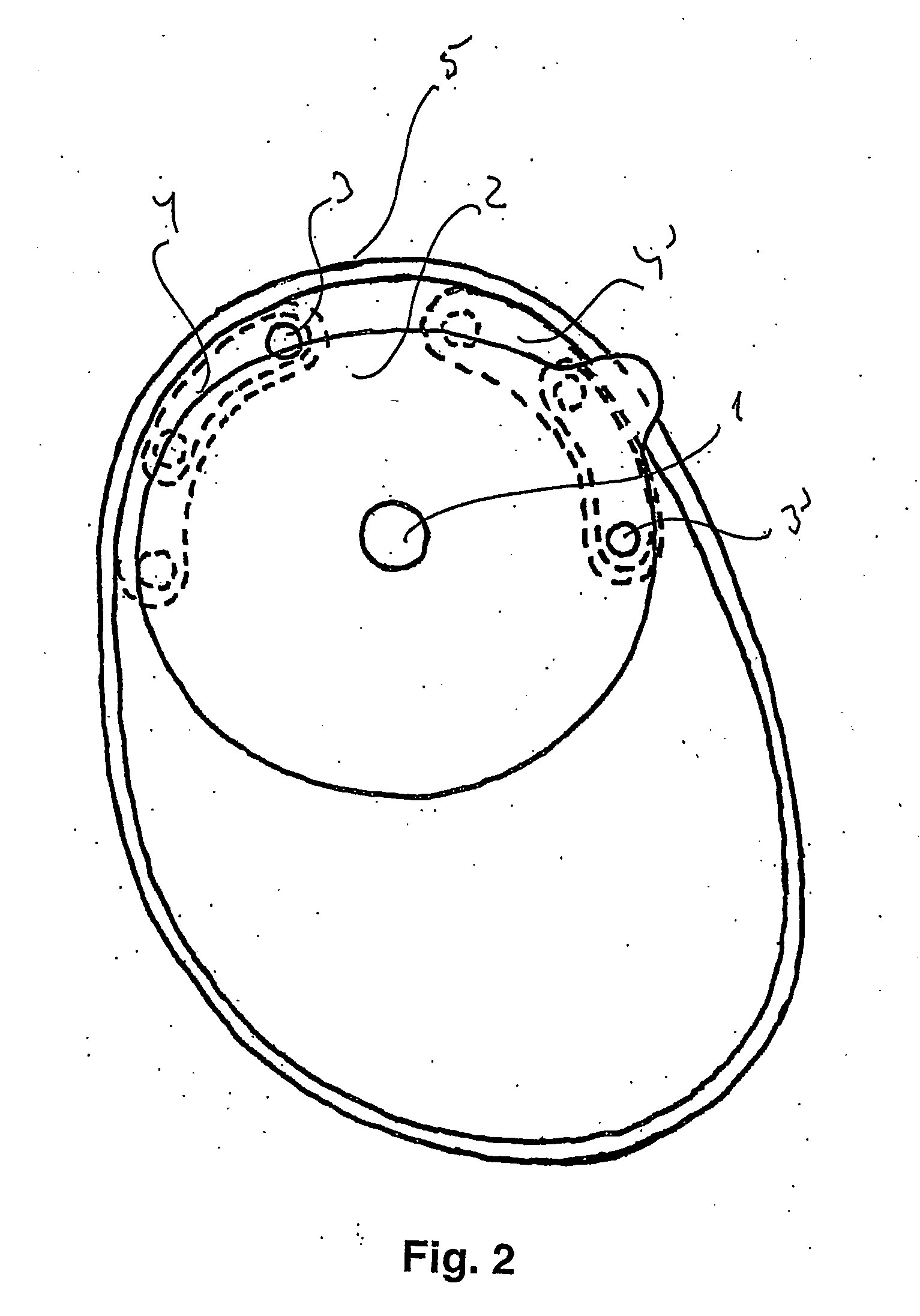 Ostomy appliance