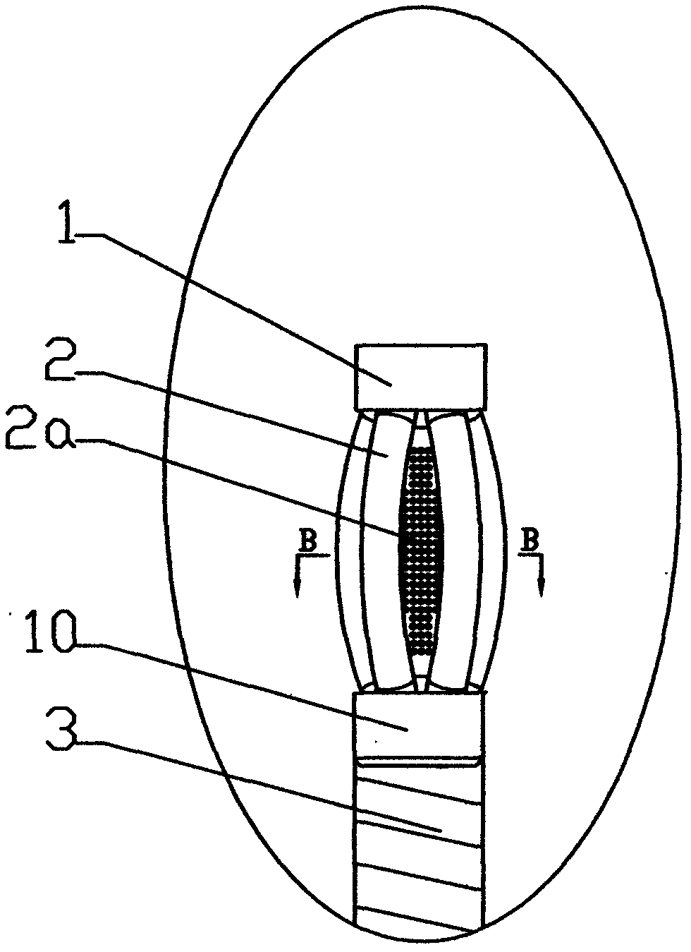 Air-controlled stone extractor