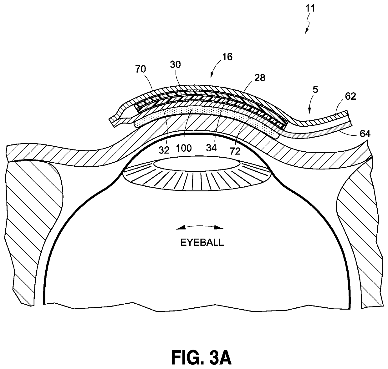 Method of measuring sedation using ocular microtremor (OMT) and microsaccades (MS)