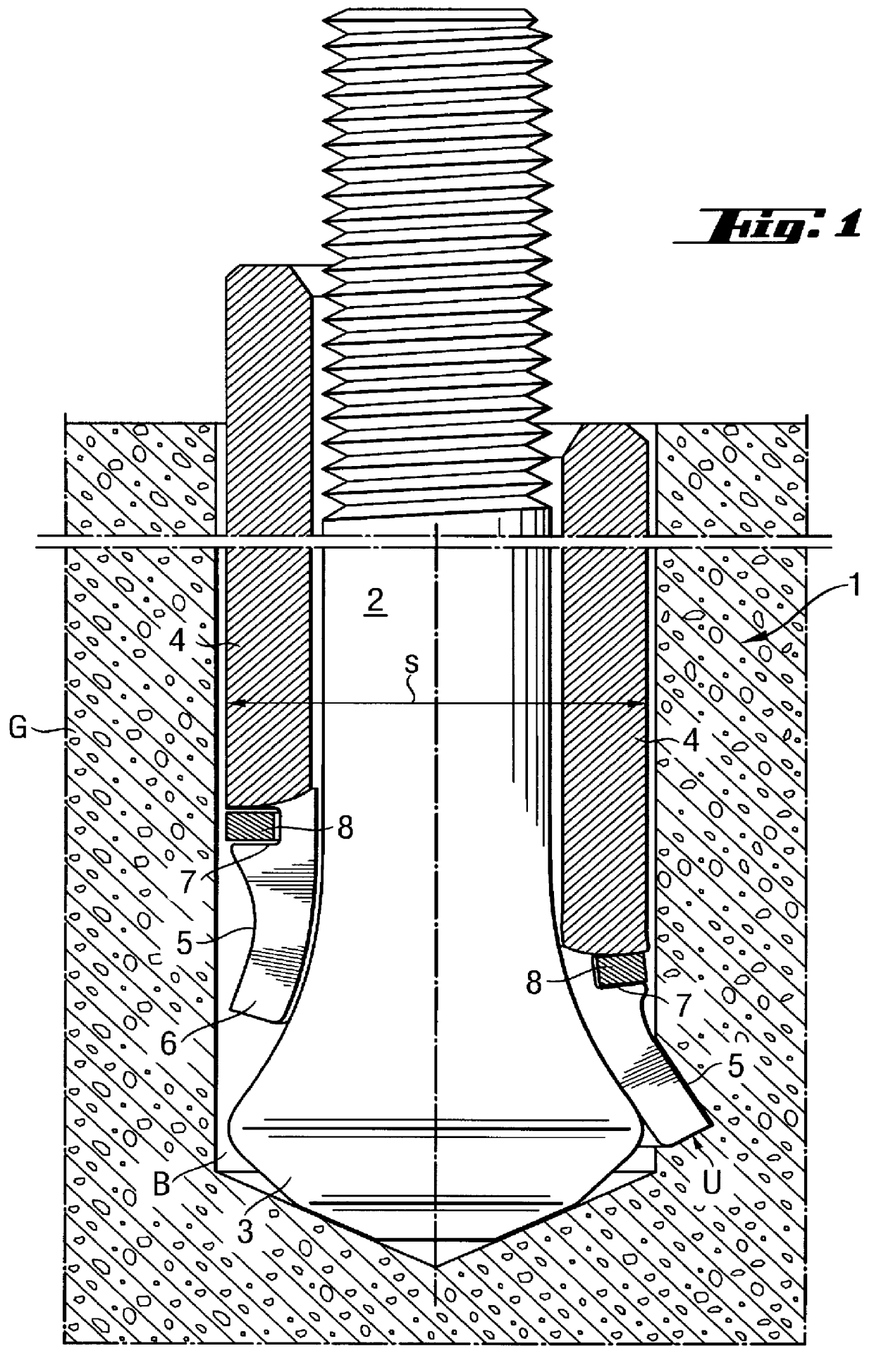 Undercut-engaging dowel