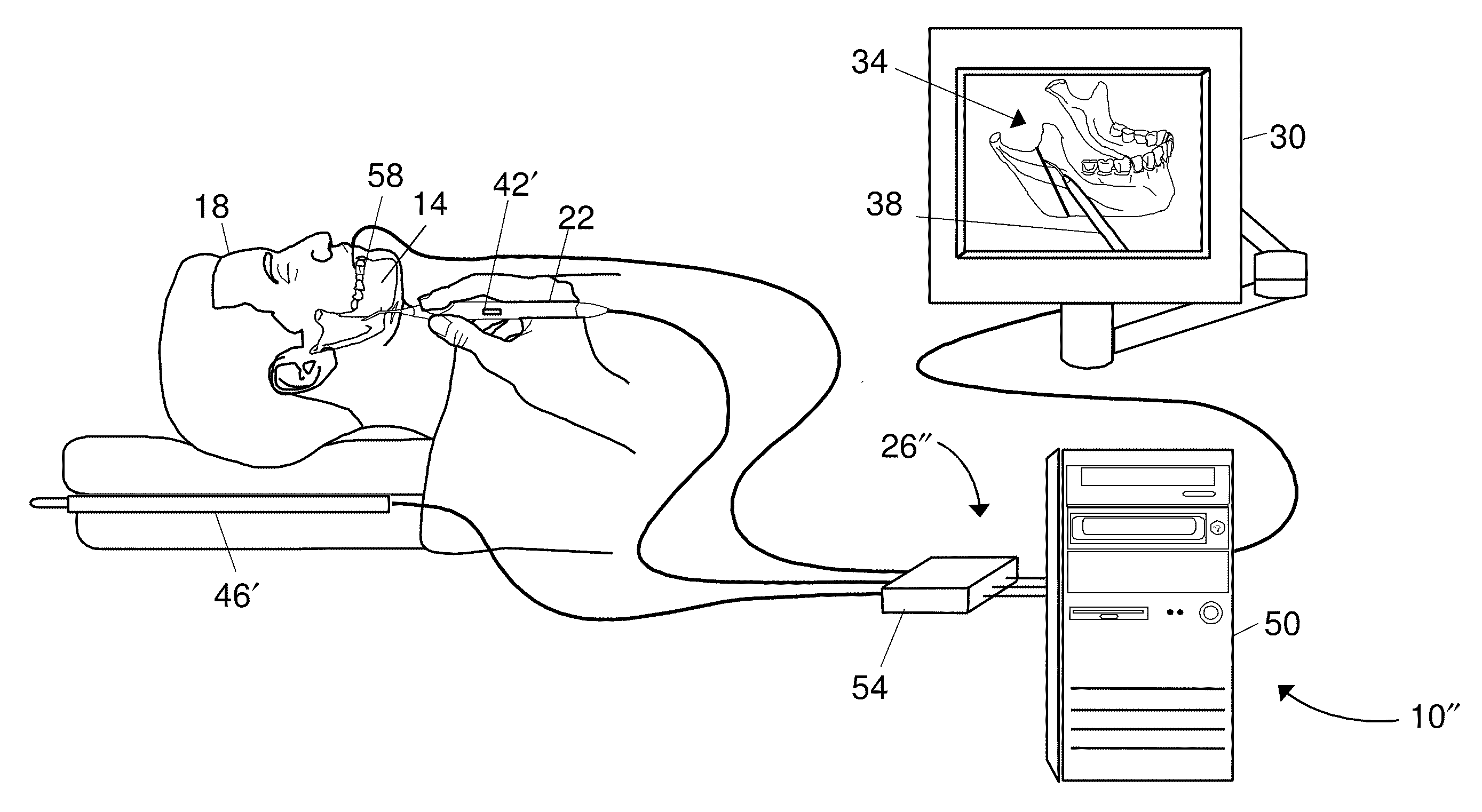 Bone Marking System and Method