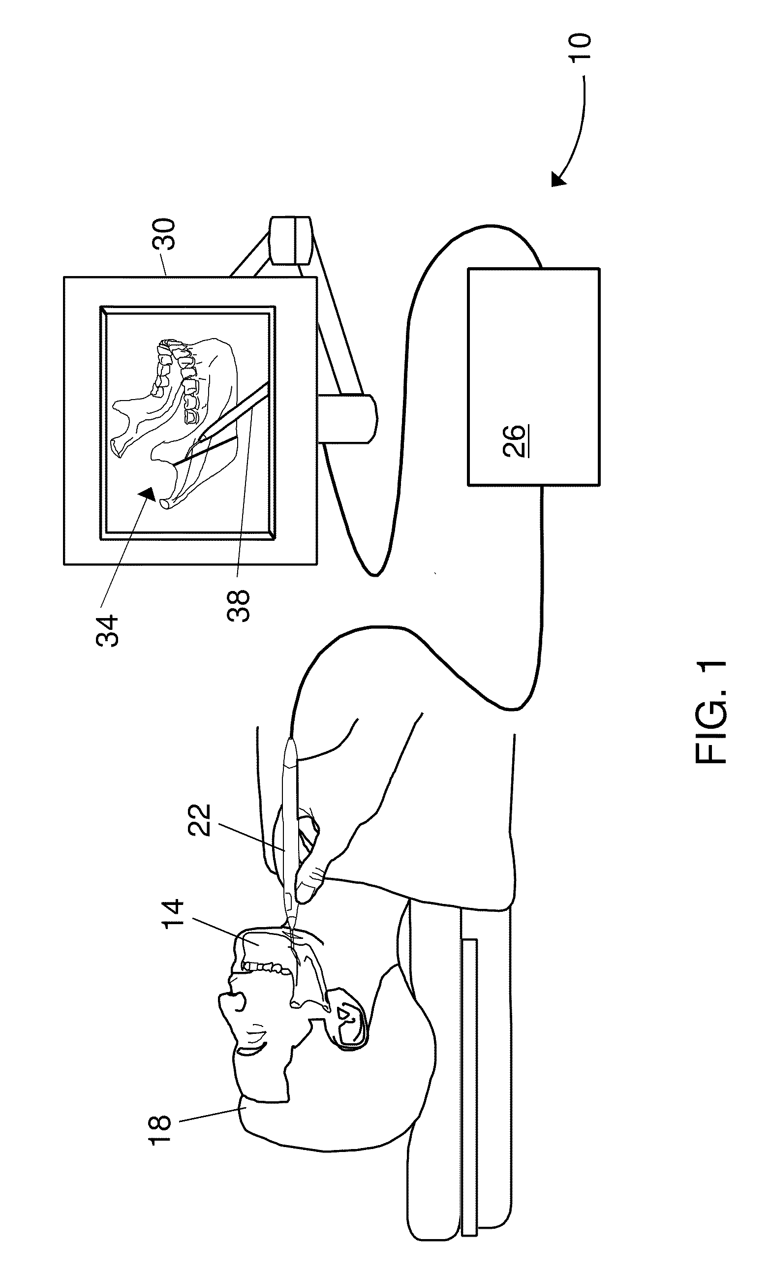 Bone Marking System and Method