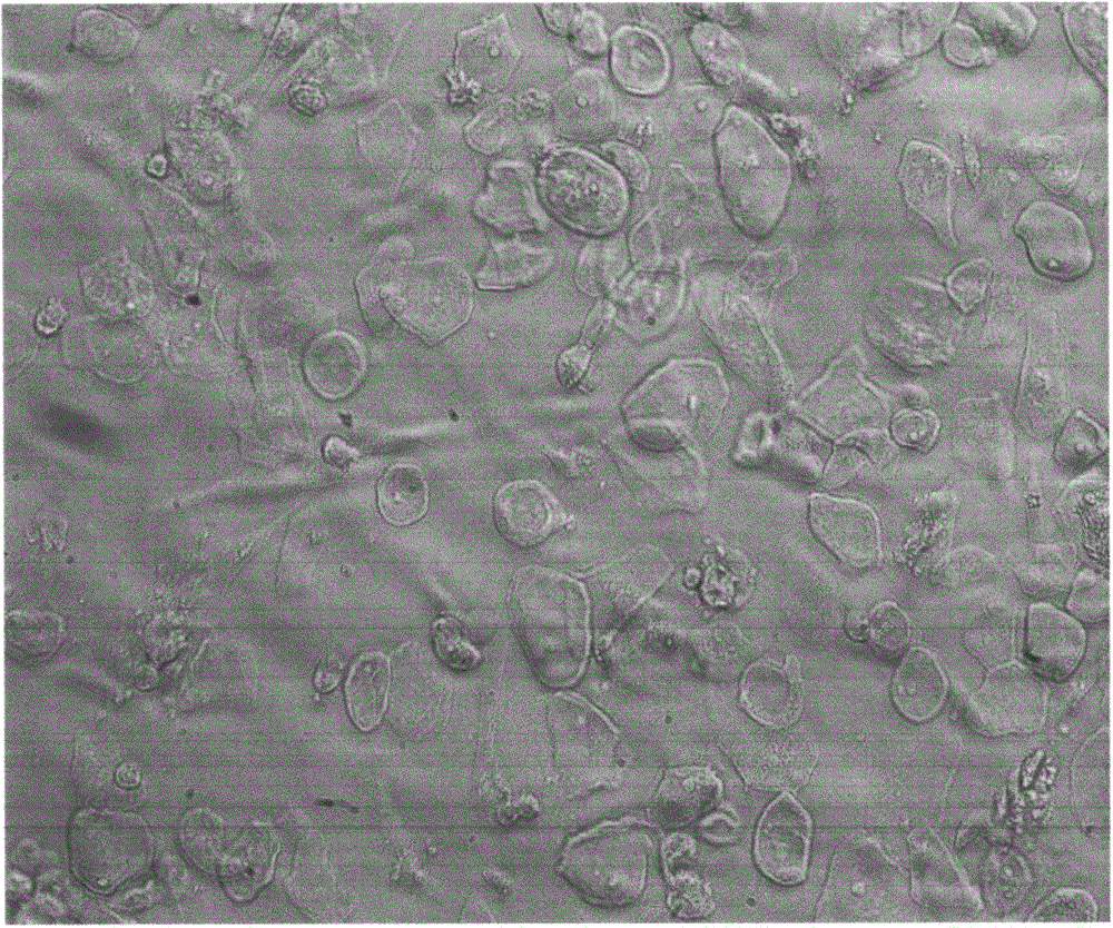 Method for constructing cell model and cell bank for chromosomal translocation by recombination of hTERT (human Telomerase Reverse Transcriptase)