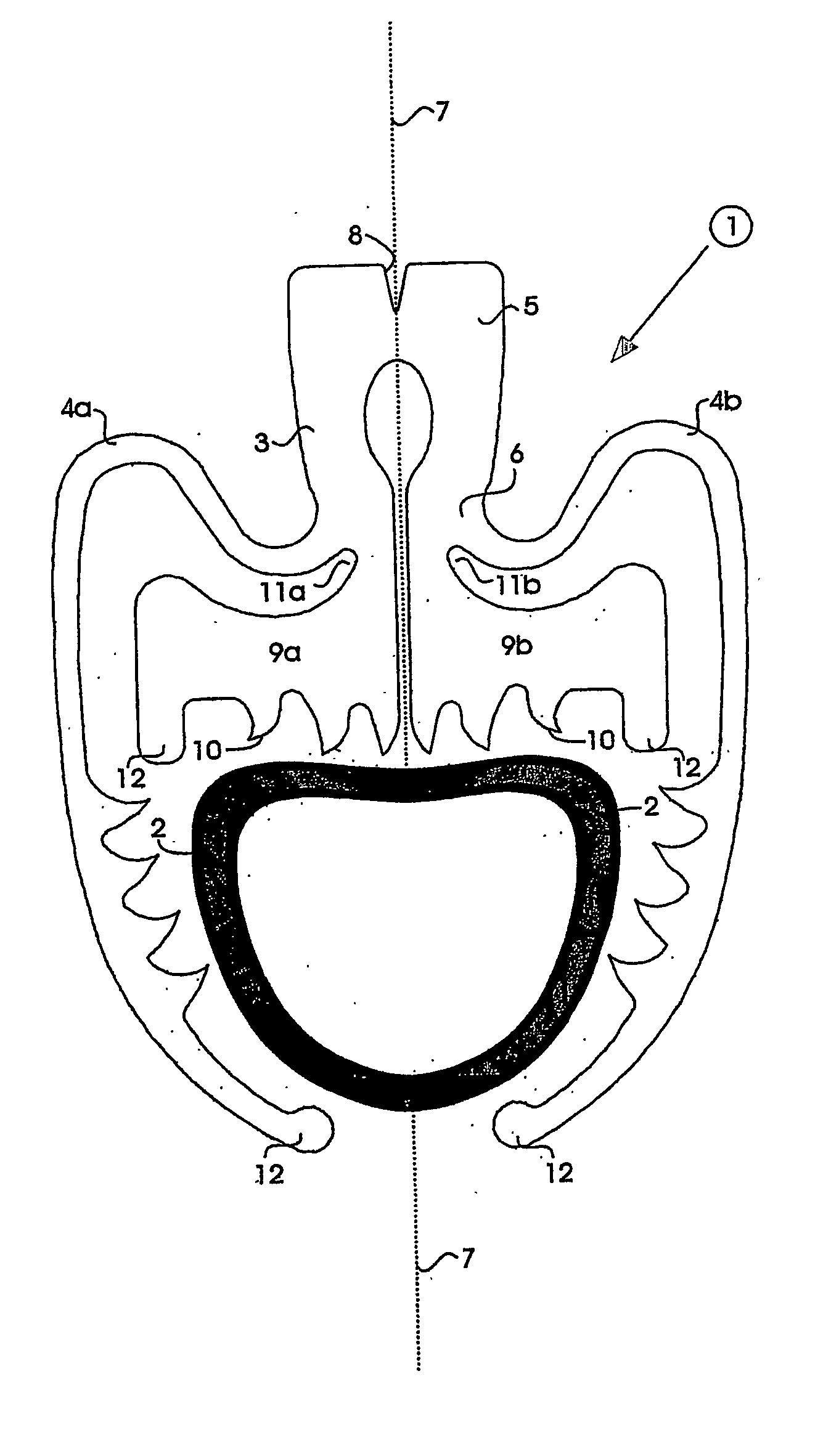 Surgical clip