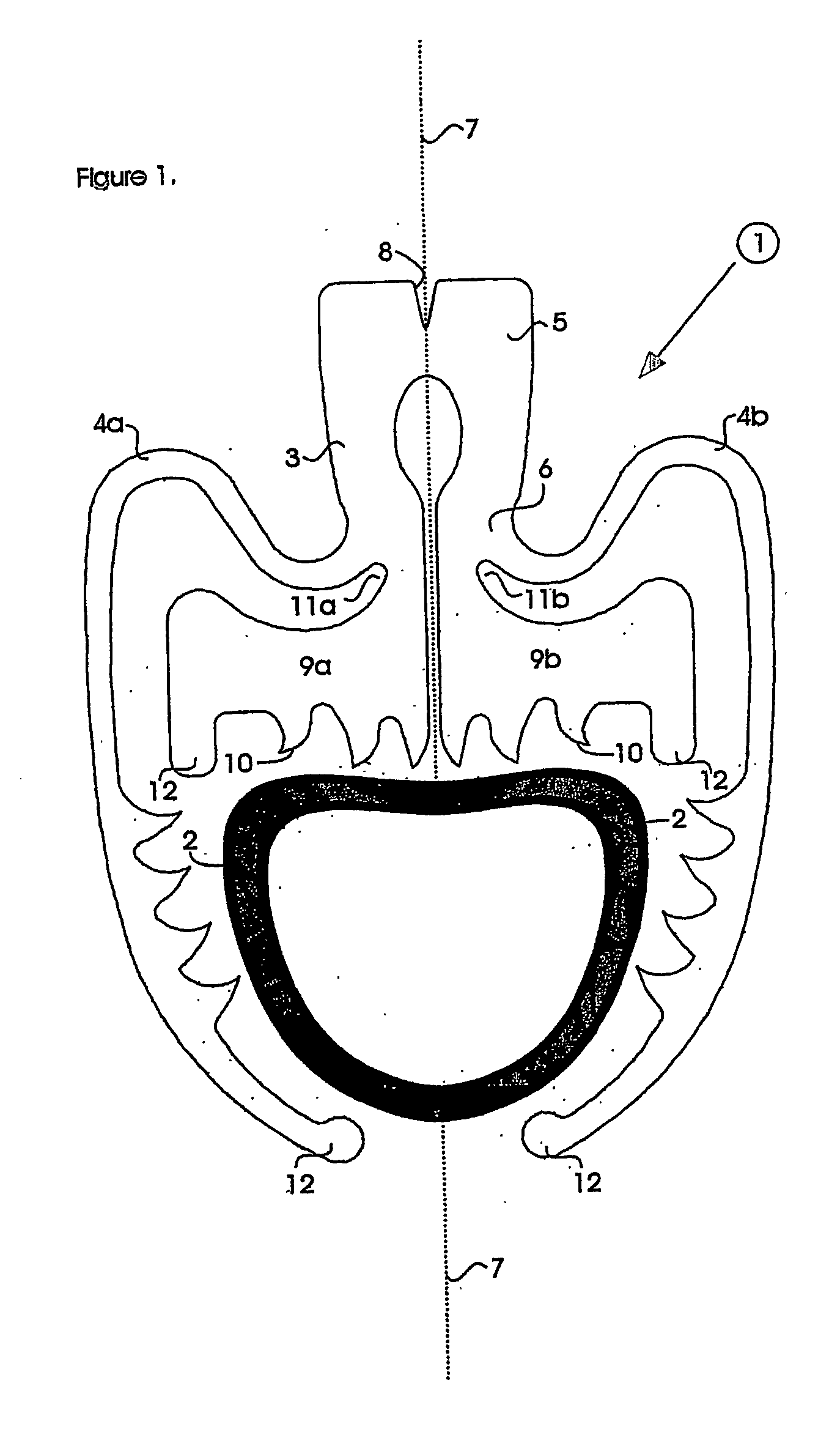 Surgical clip