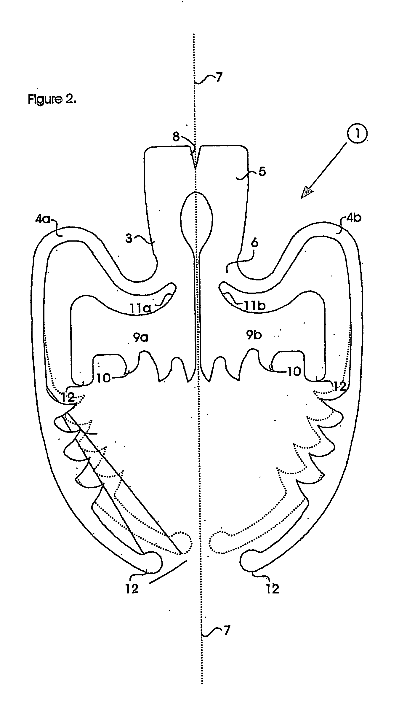 Surgical clip