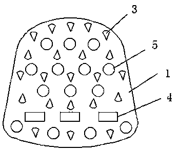 An absorbable spacer for high tibial osteotomy