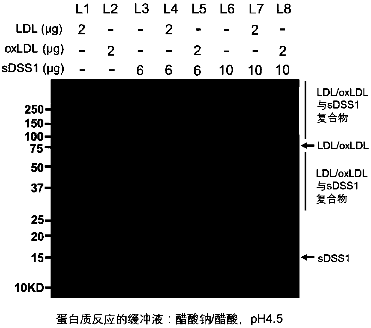 Application of protein in preparation of medicine for preventing and treating atherosclerosis and complications