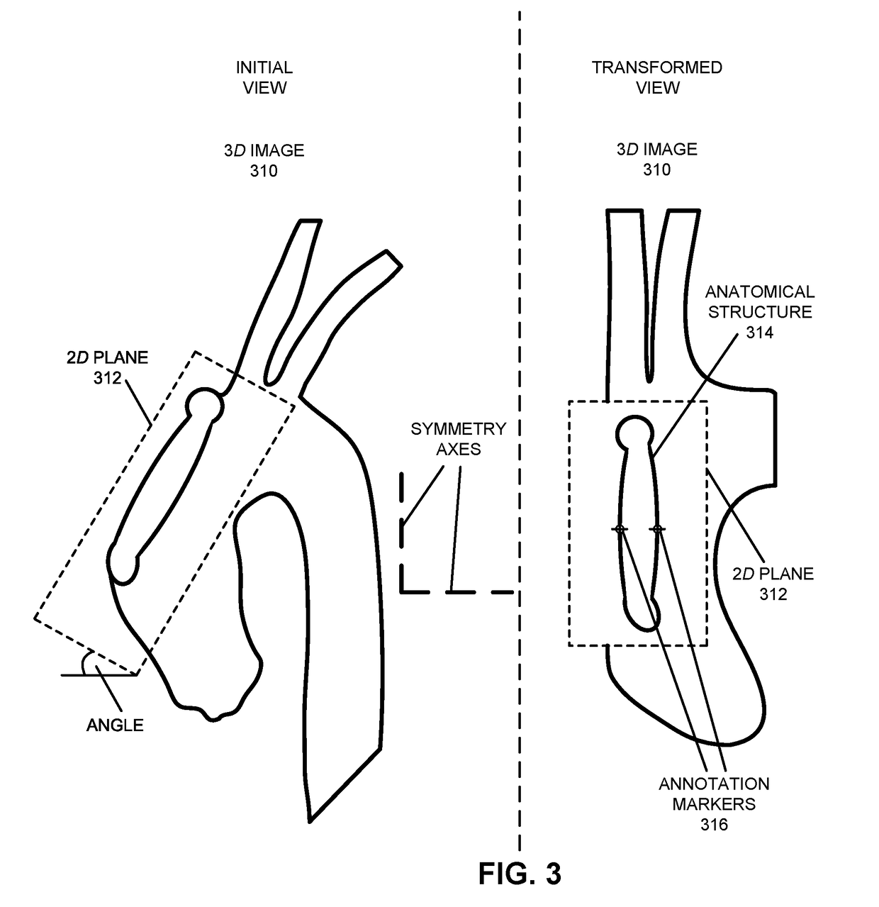 Multi-Point Annotation Using a Haptic Plane