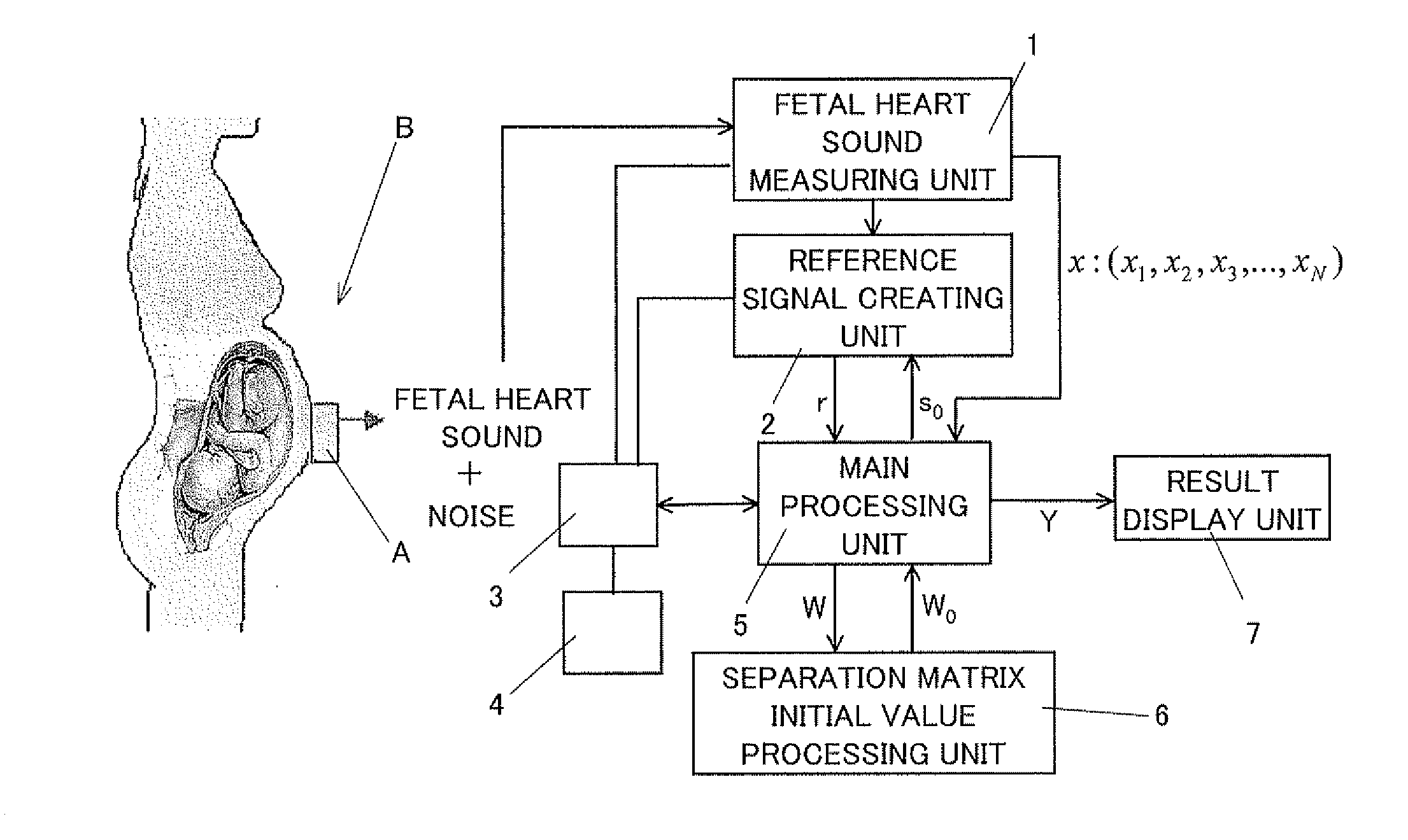 Signal extracting apparatus