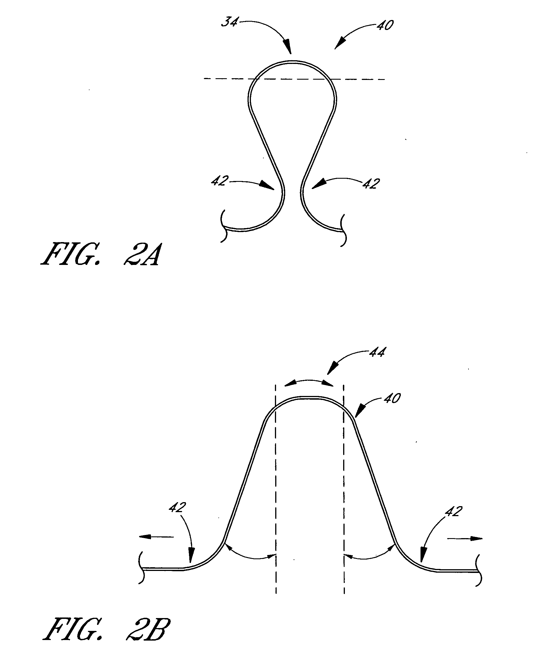 Heart failure treatment device and method