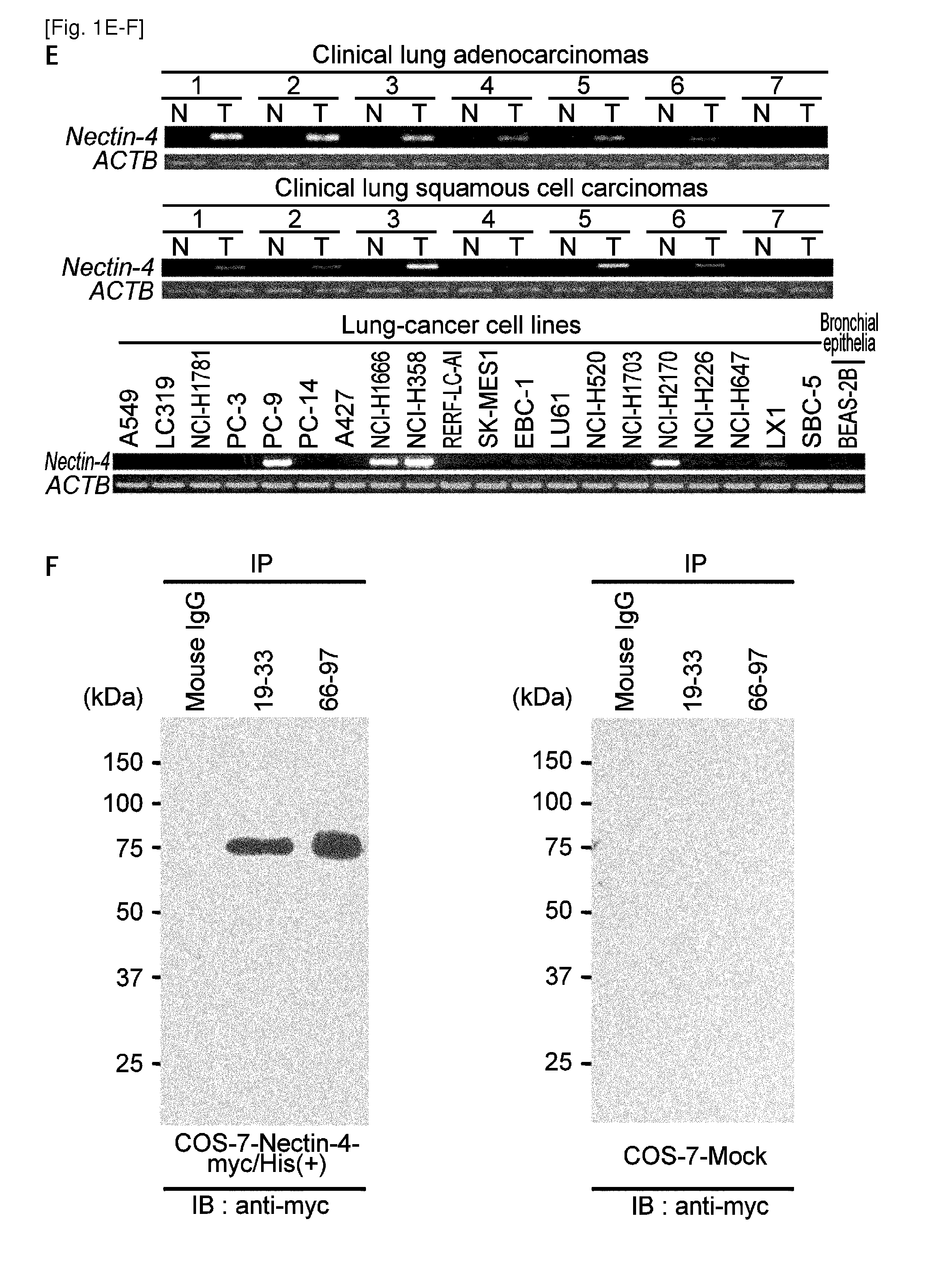 Nectin-4 for target genes of cancer therapy and diagnosis