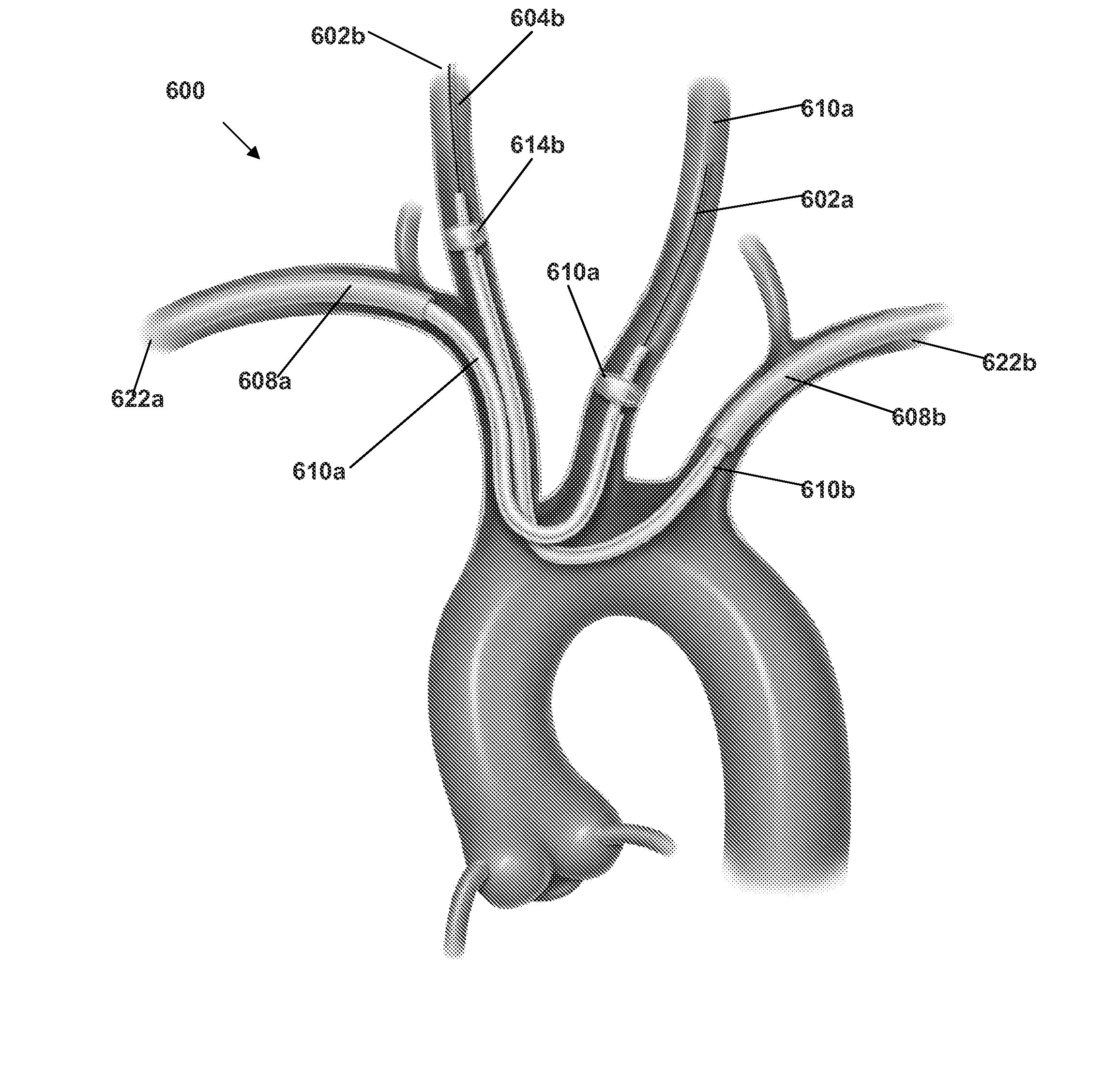 Embolism protection device