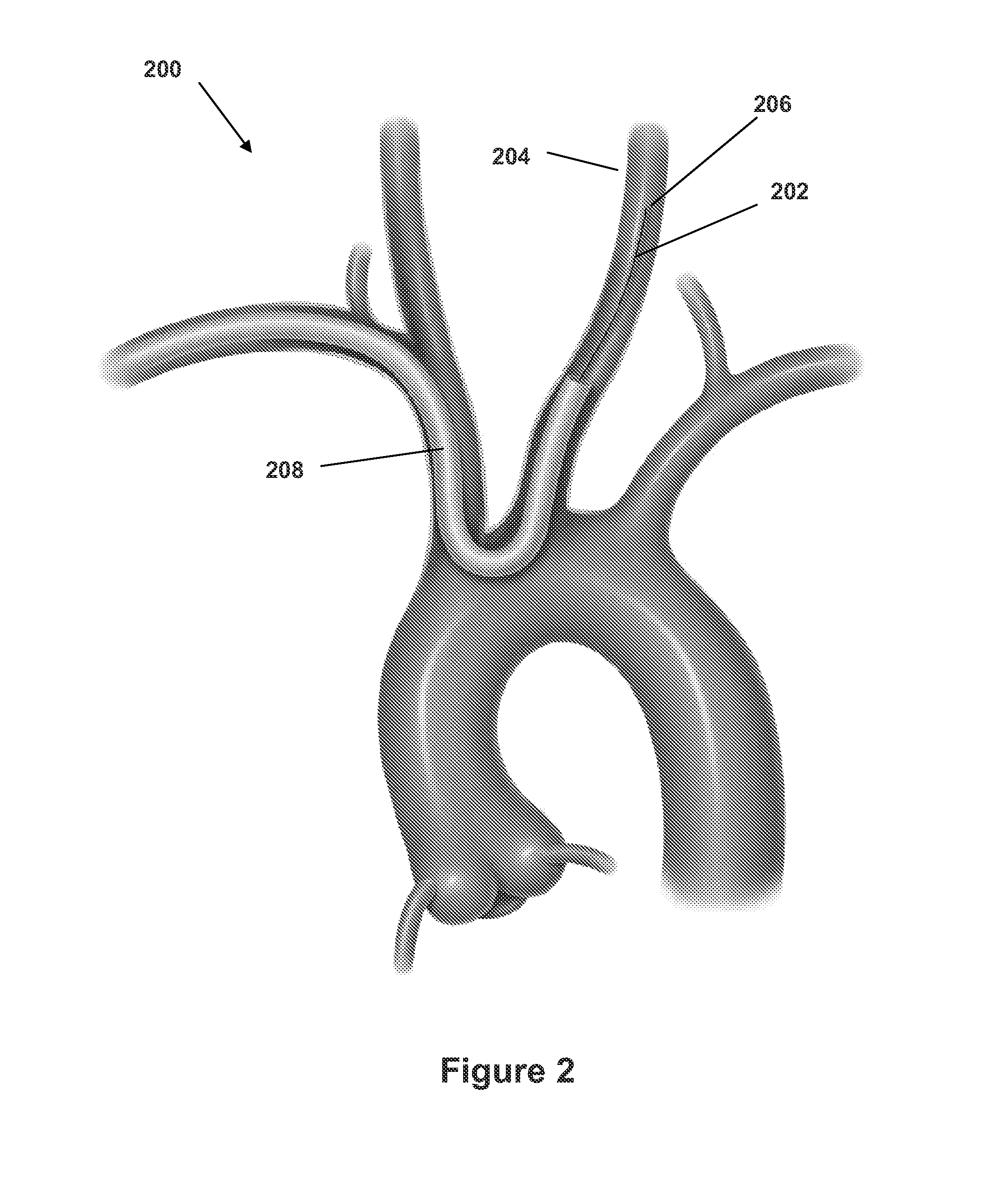 Embolism protection device