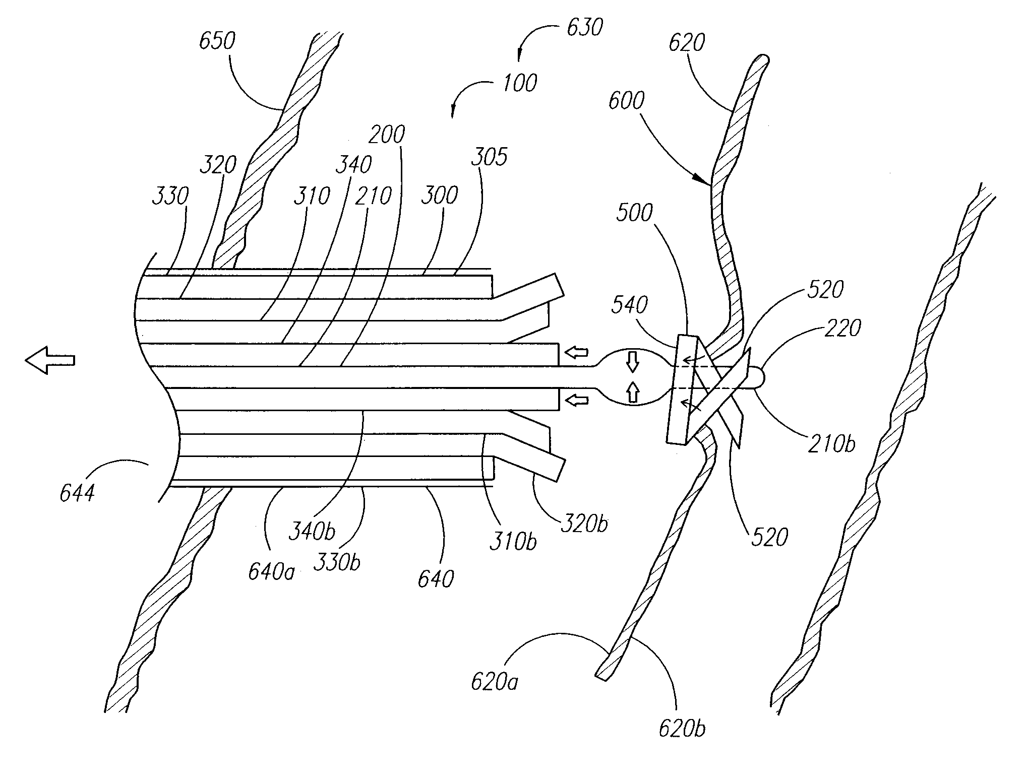 Clip applier and methods of use