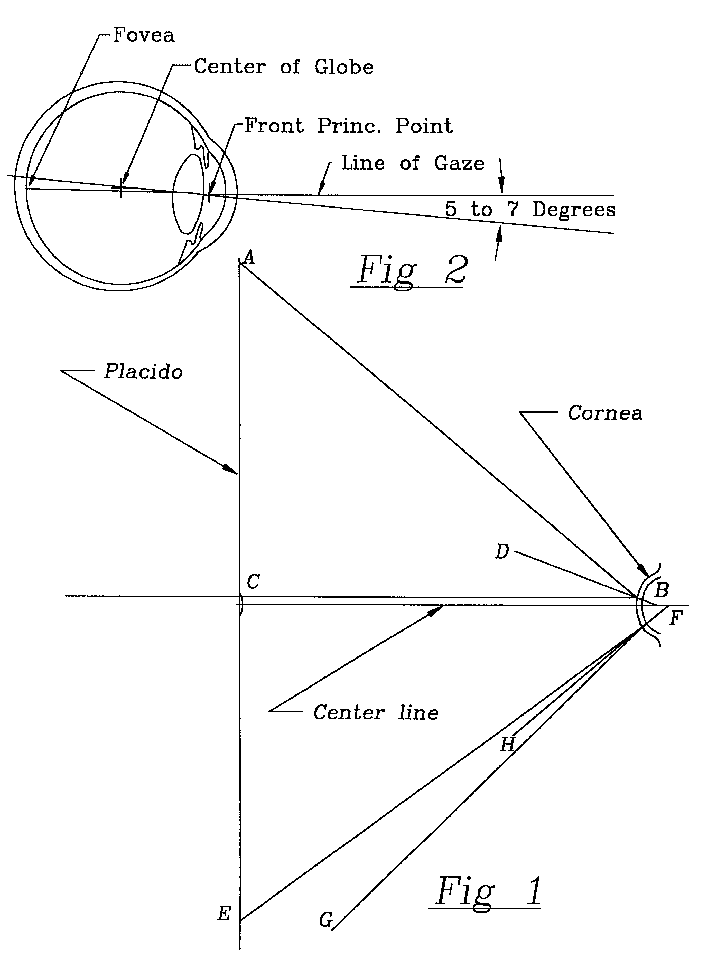 Keratometer/pachymeter