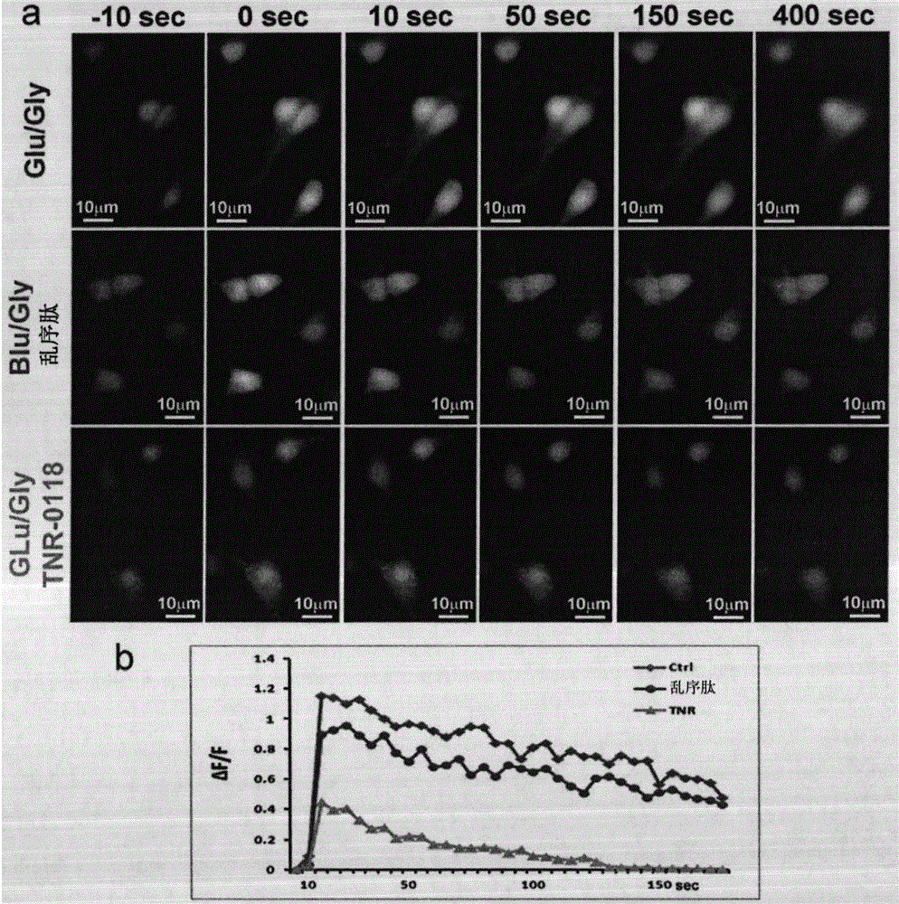 Compositions and methods for treating traumatic brain injury