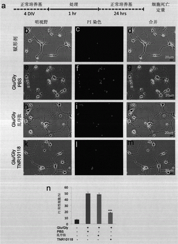 Compositions and methods for treating traumatic brain injury