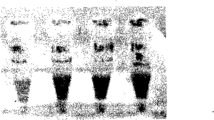 Method for preparing quantum dot immune fluorescent probe