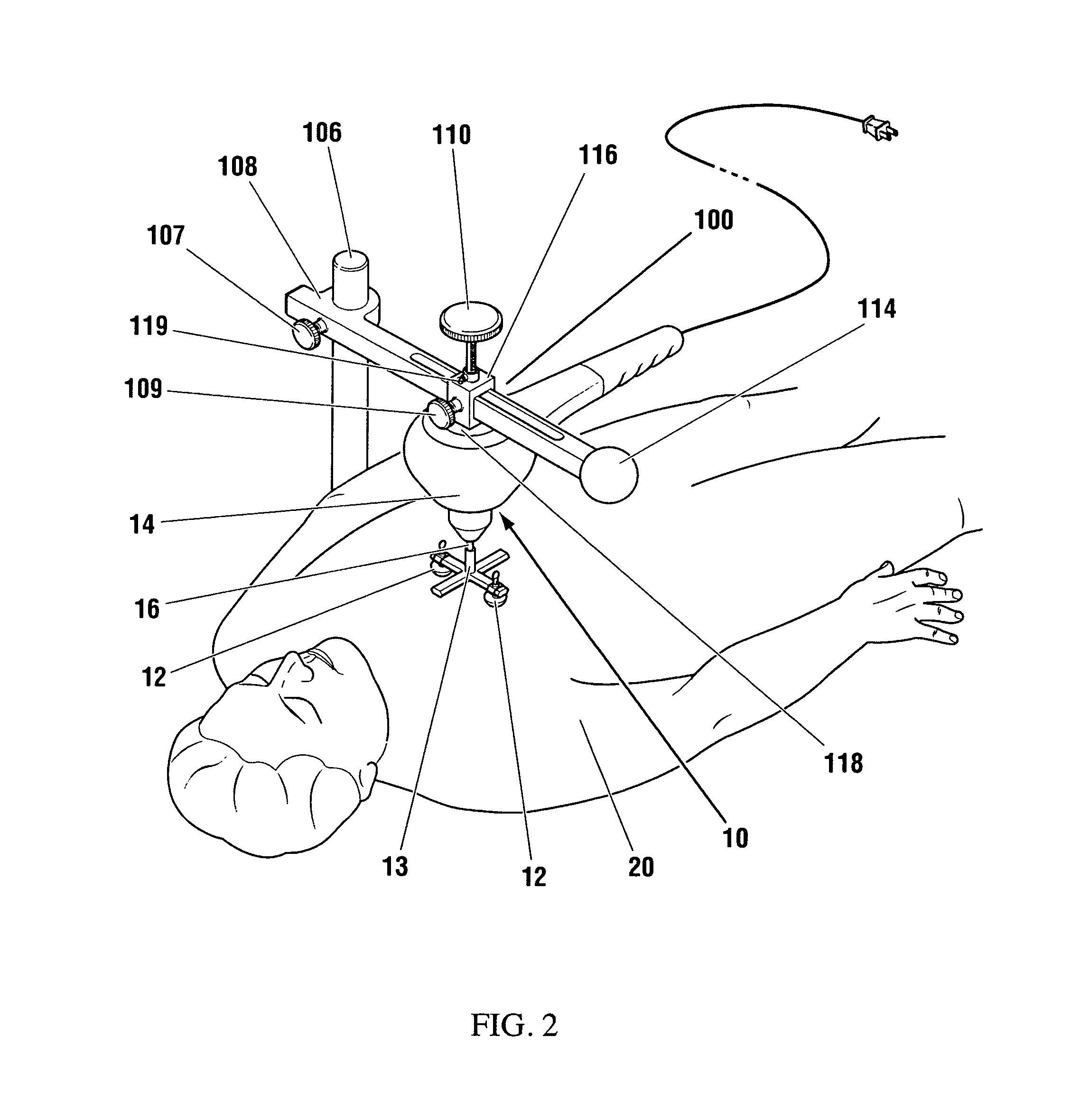 Vibration method for clearing acute arterial thrombotic occlusions in the emergency treatment of heart attack and stroke