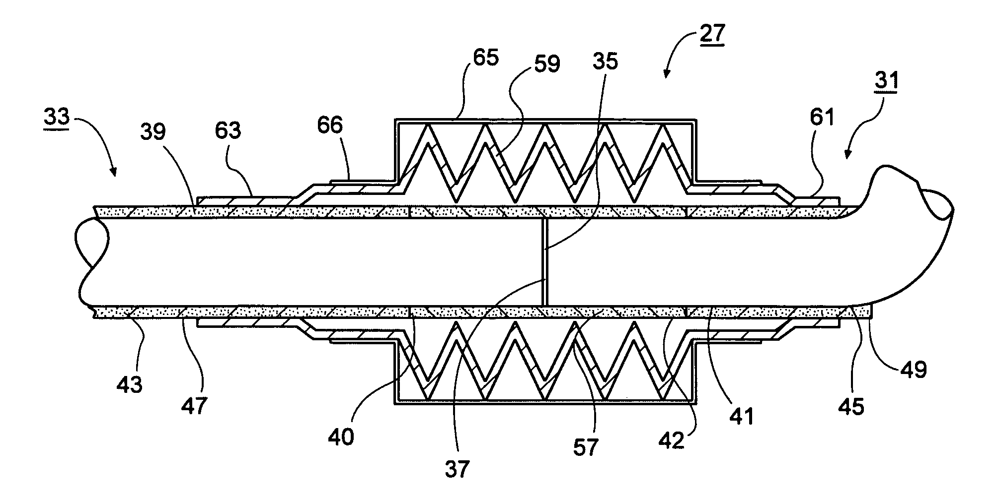 High temperature line expansion installation with bellows