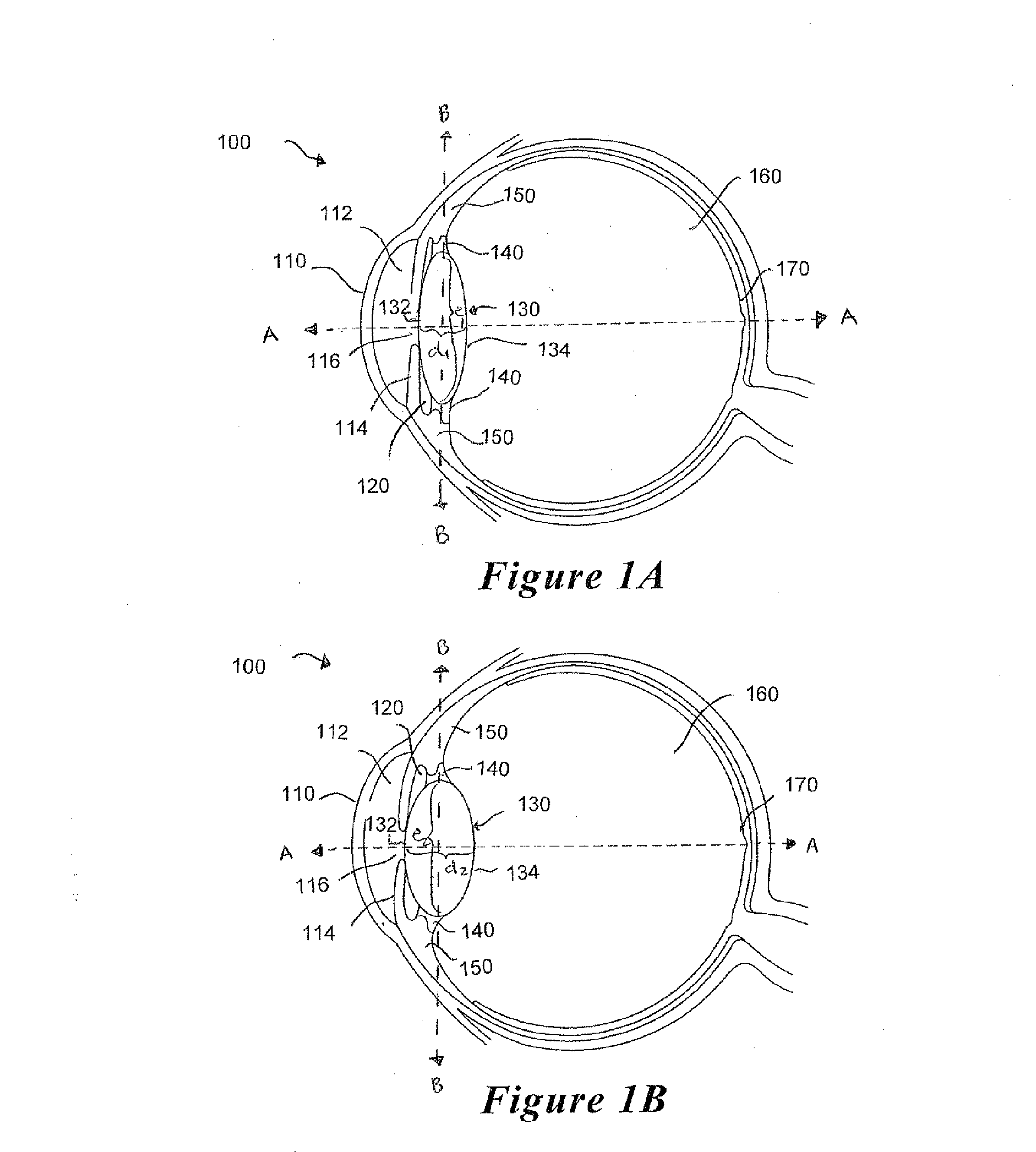 Accommodating intraocular lens device