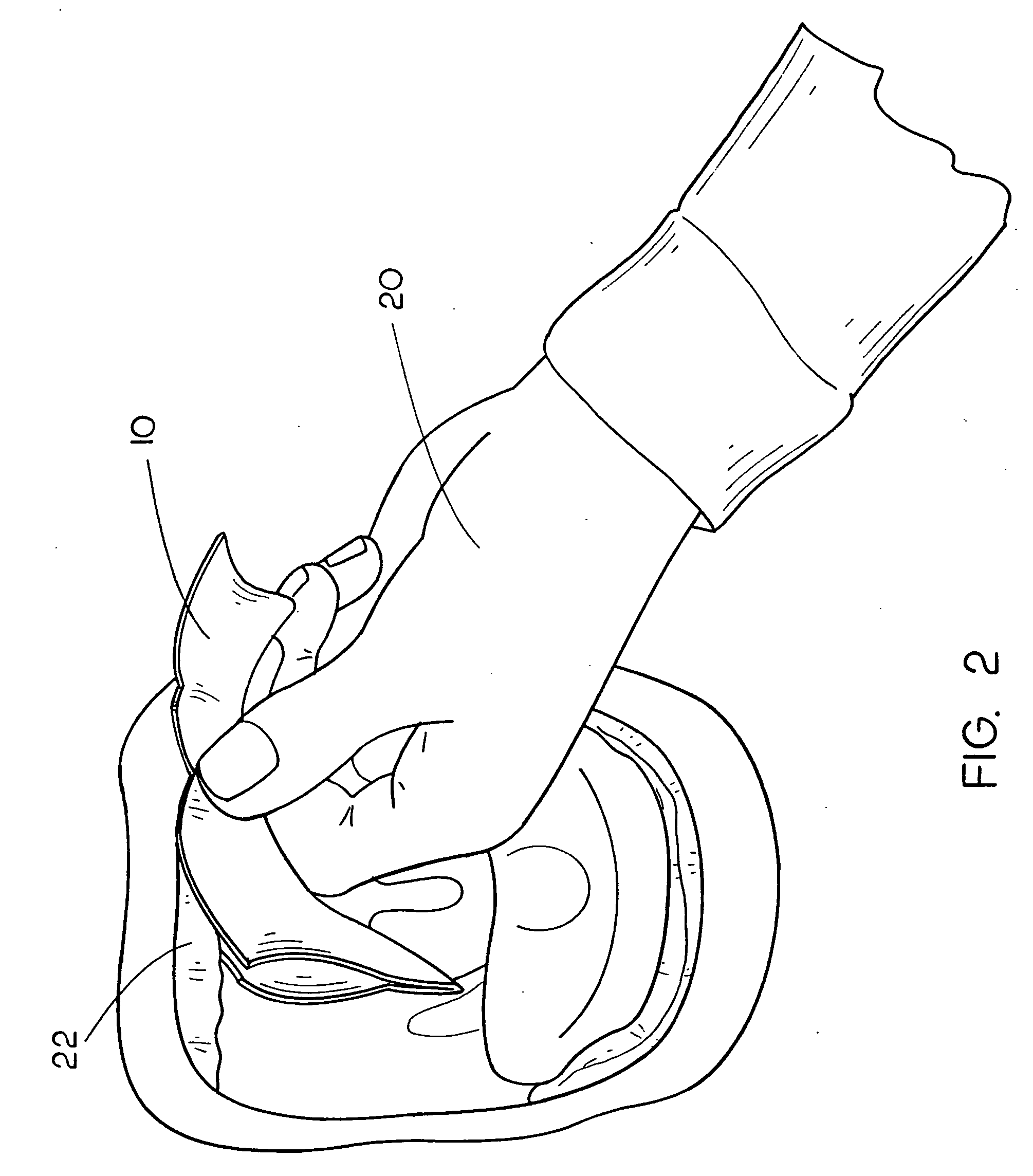 Denture adhesive removal method