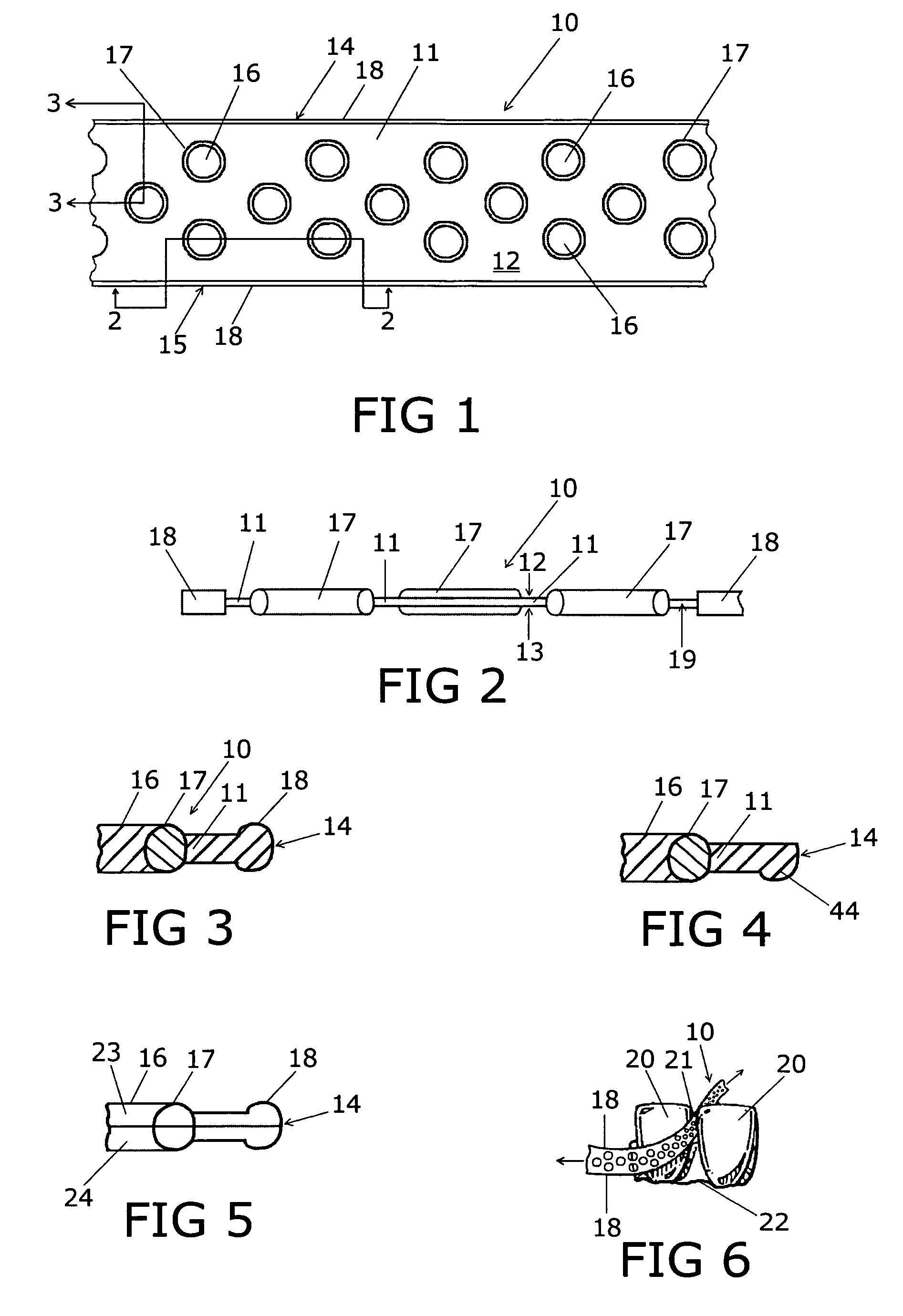 Dental cleaning device