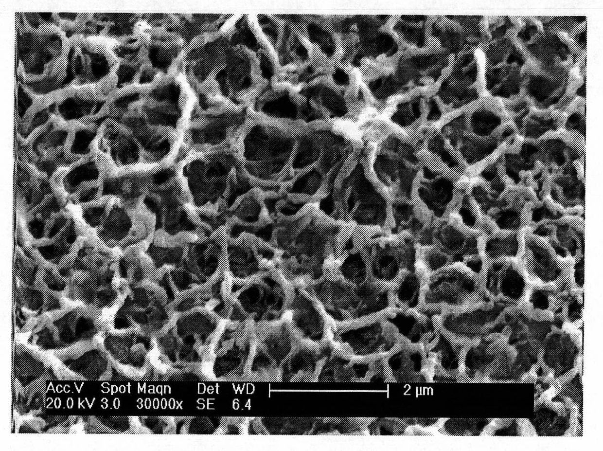 Antibacterial artificial tooth root with bioactivity and preparation method thereof