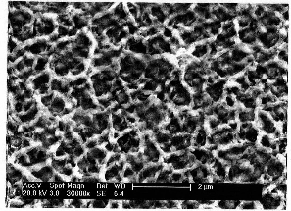 Antibacterial artificial tooth root with bioactivity and preparation method thereof