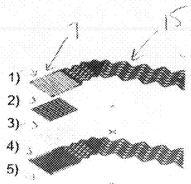 System and method for emg signal acquisition