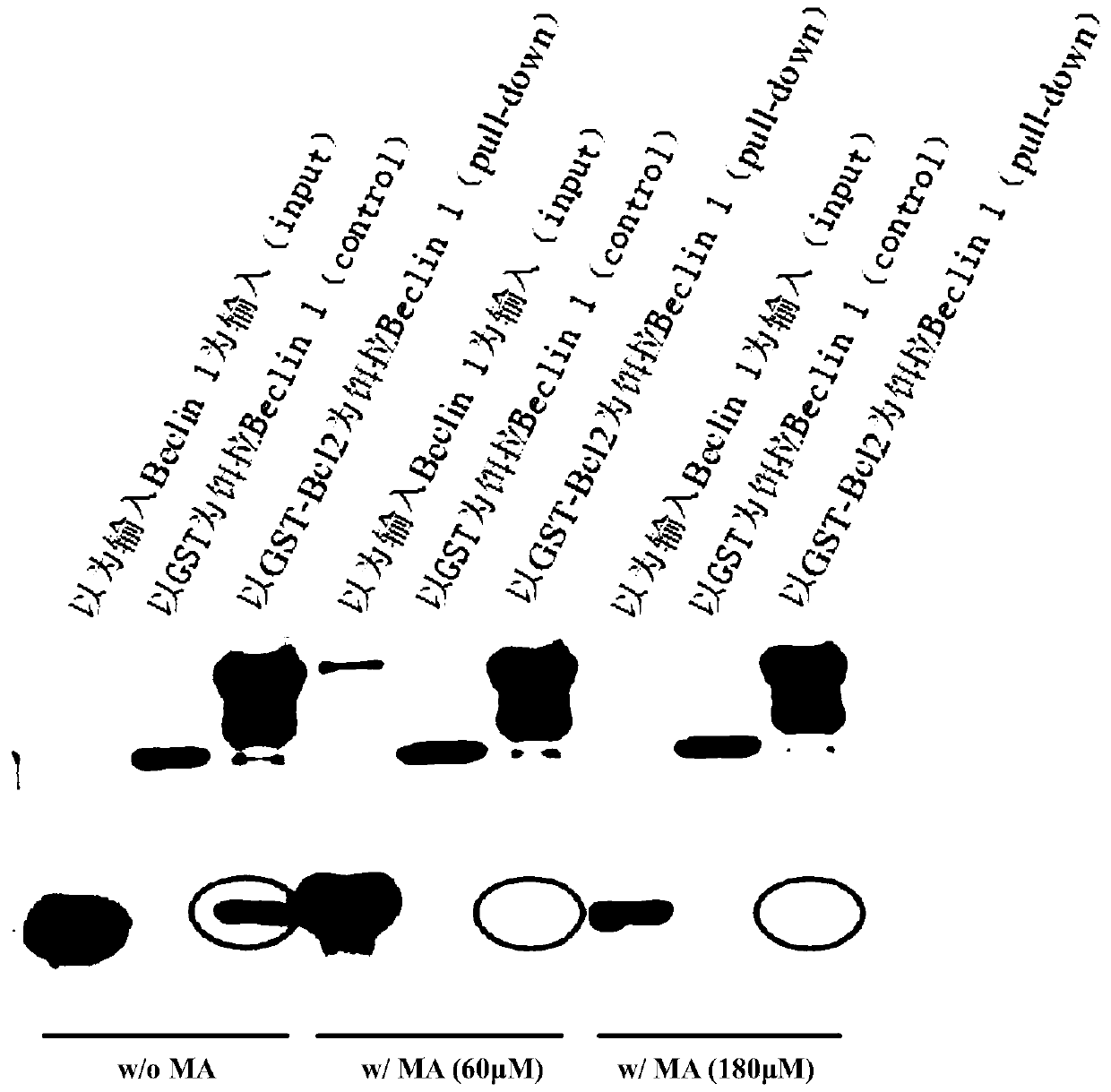 Application of triterpenoids in the preparation of Parkinson's medicines